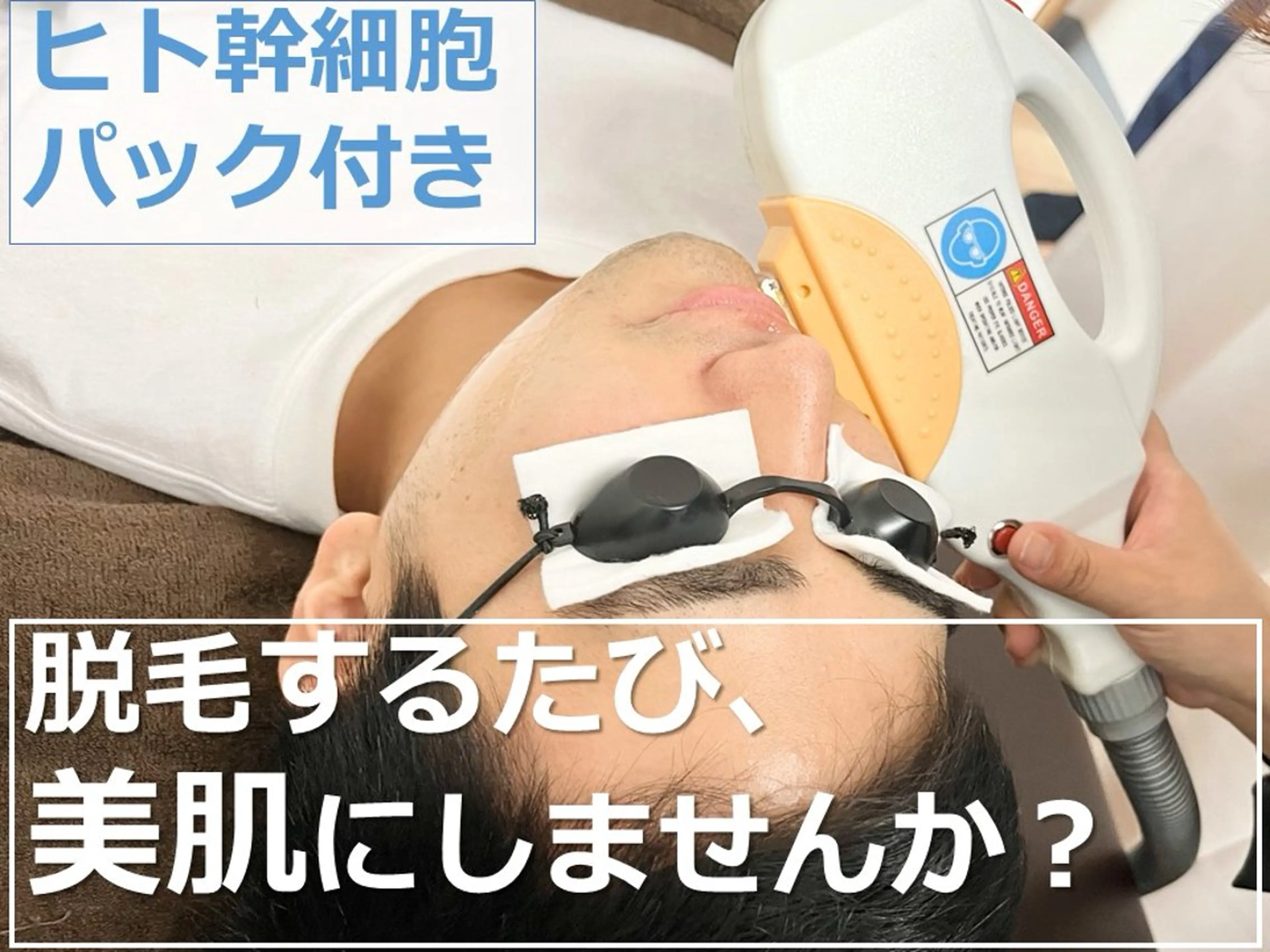 髭脱毛×ヒト幹細胞パックの写真