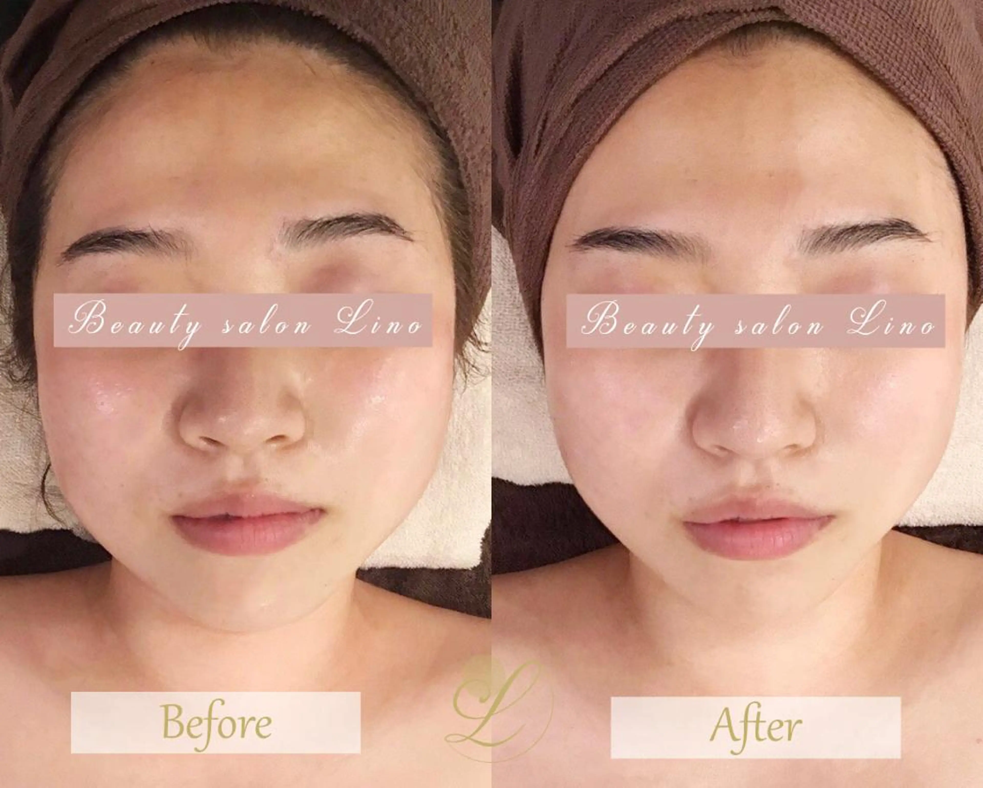 痩身×フェイシャル ブライダル|Linoのエステ・リラクイメージ