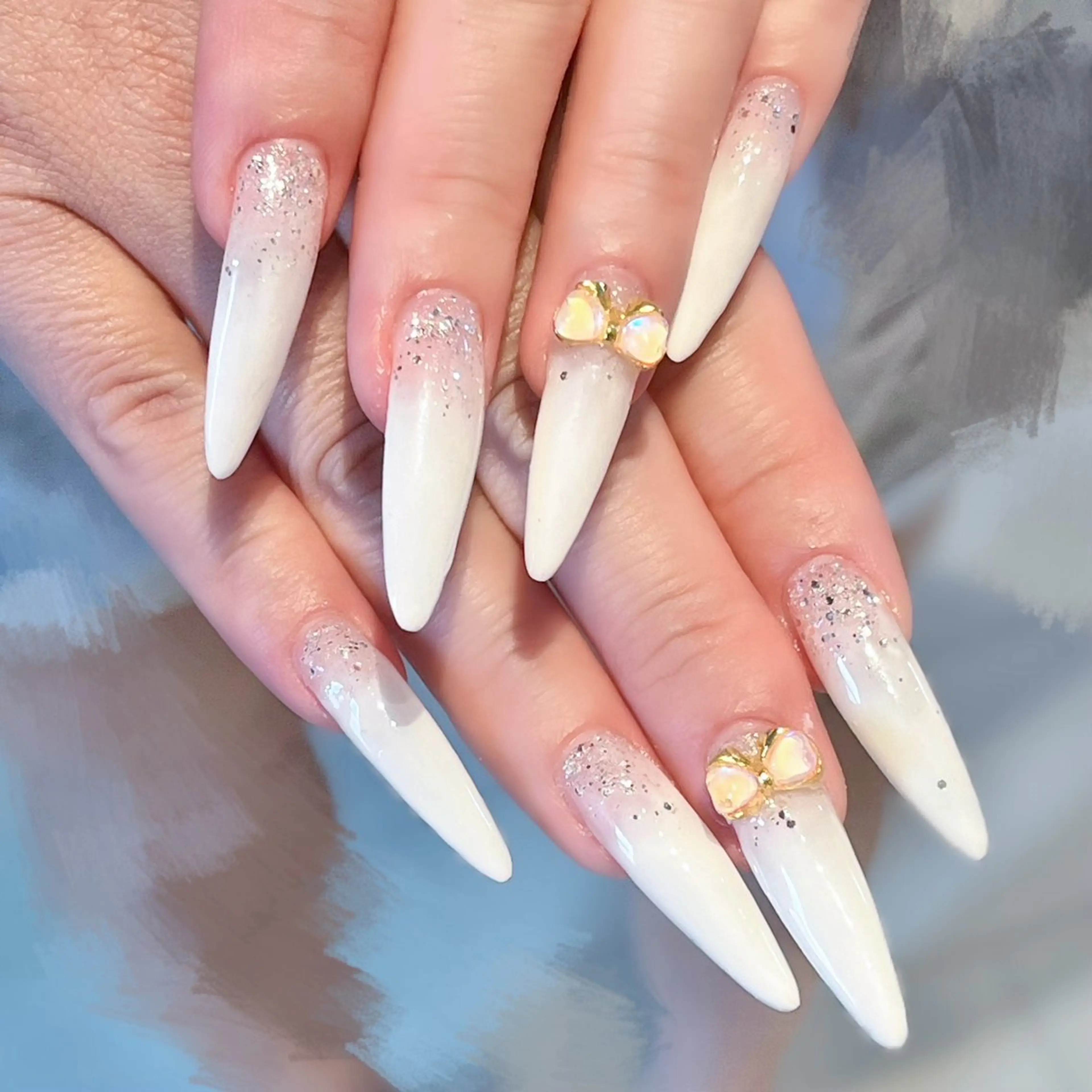 チップスカルプ定額ネイルの写真