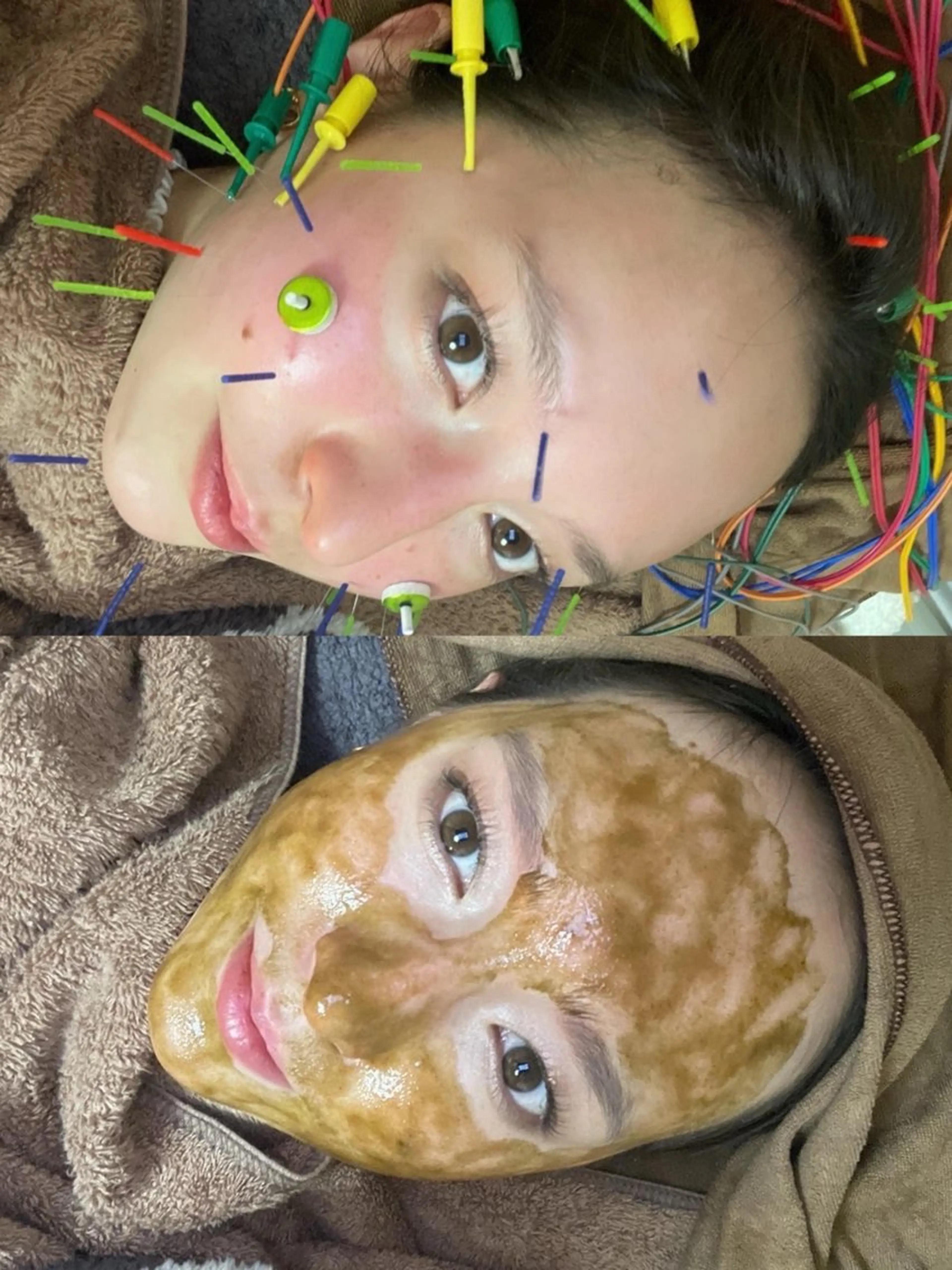 美容鍼灸サロン mahoroba院長のエステ・リラクイメージ