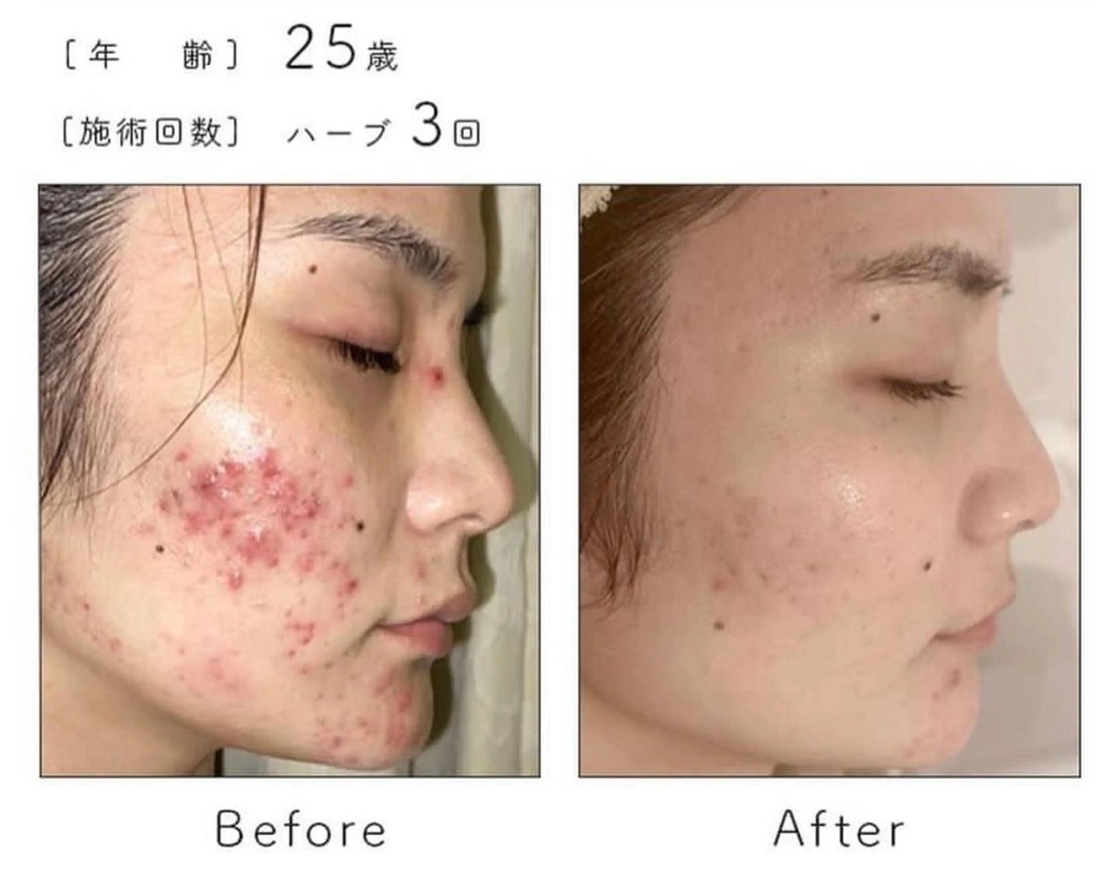トモ化粧品所属・松井 莉奈のマツエク・マツパデザイン