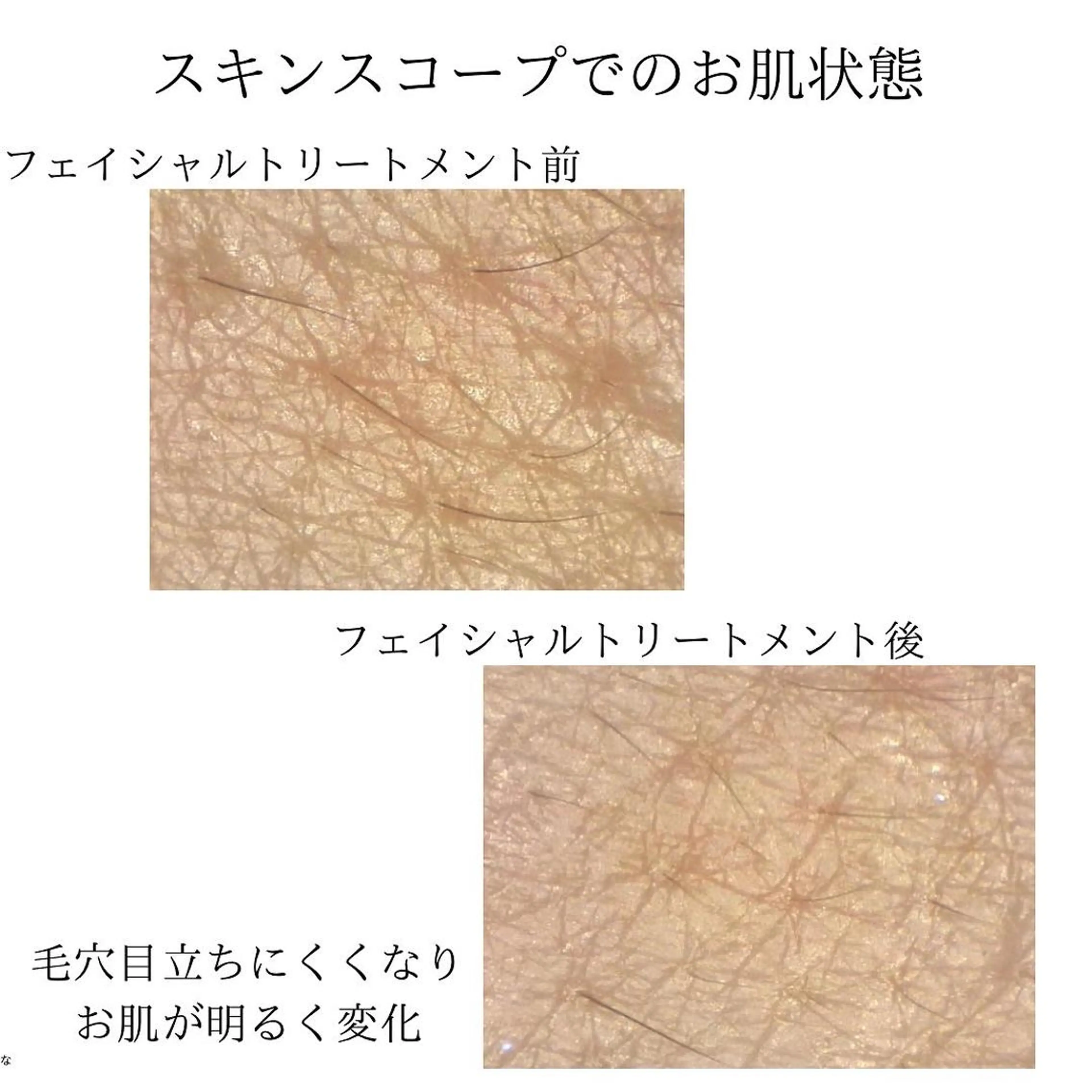 ビューティスタジオ ti.kreisのエステ・リラクイメージ