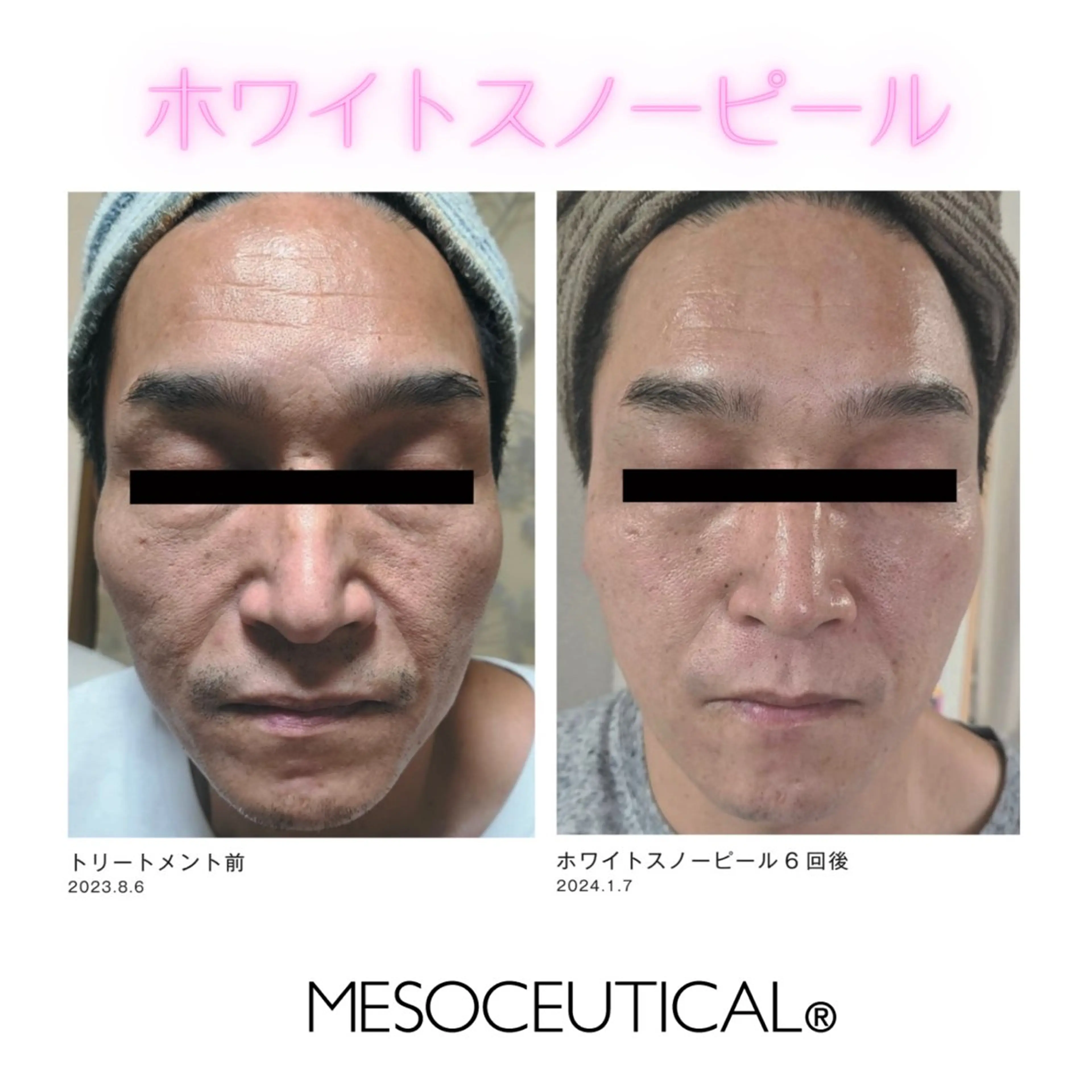 アドミーロ 💎CHIKA💎のエステ・リラクイメージ