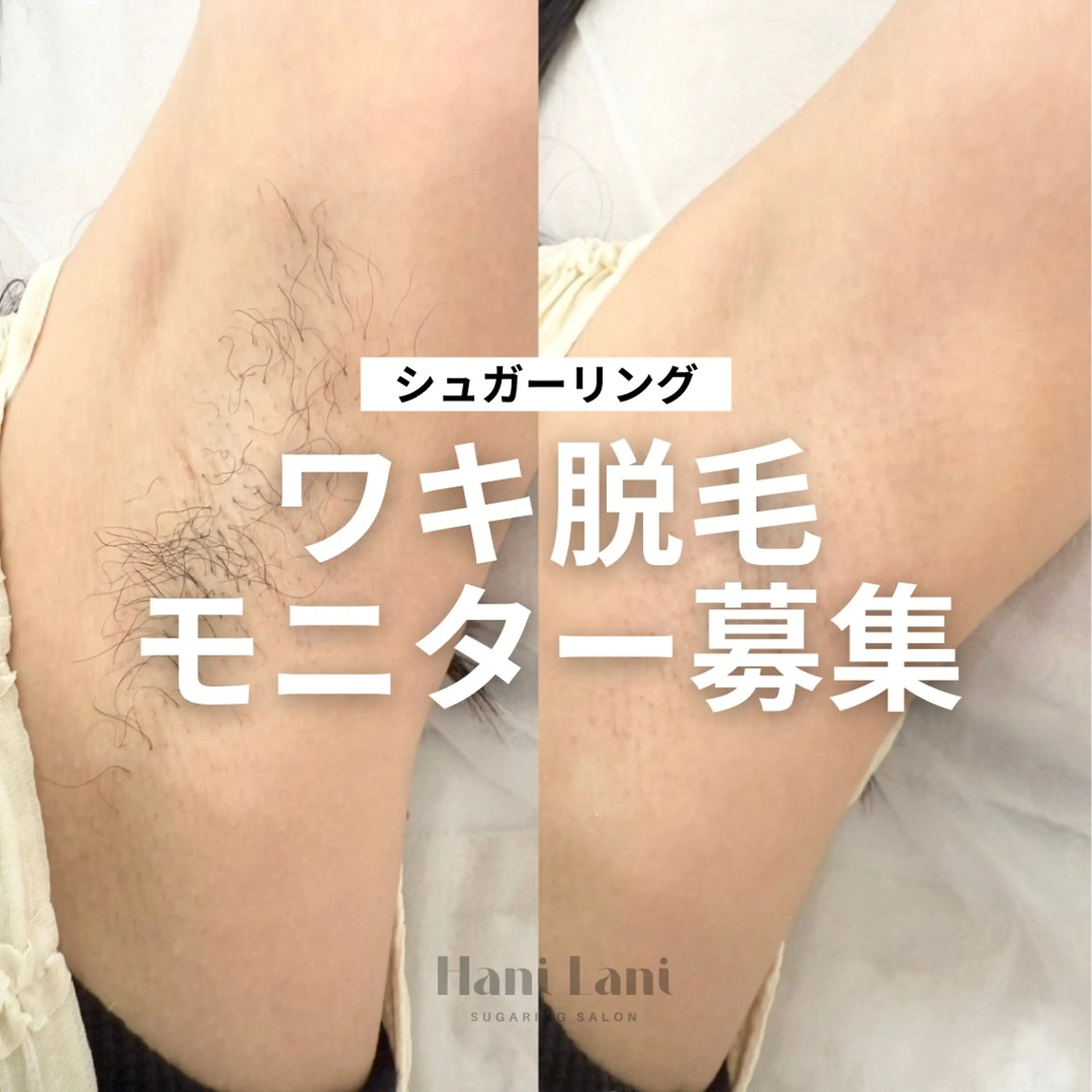【モニター募集】両ワキ🌻シュガーリングの写真