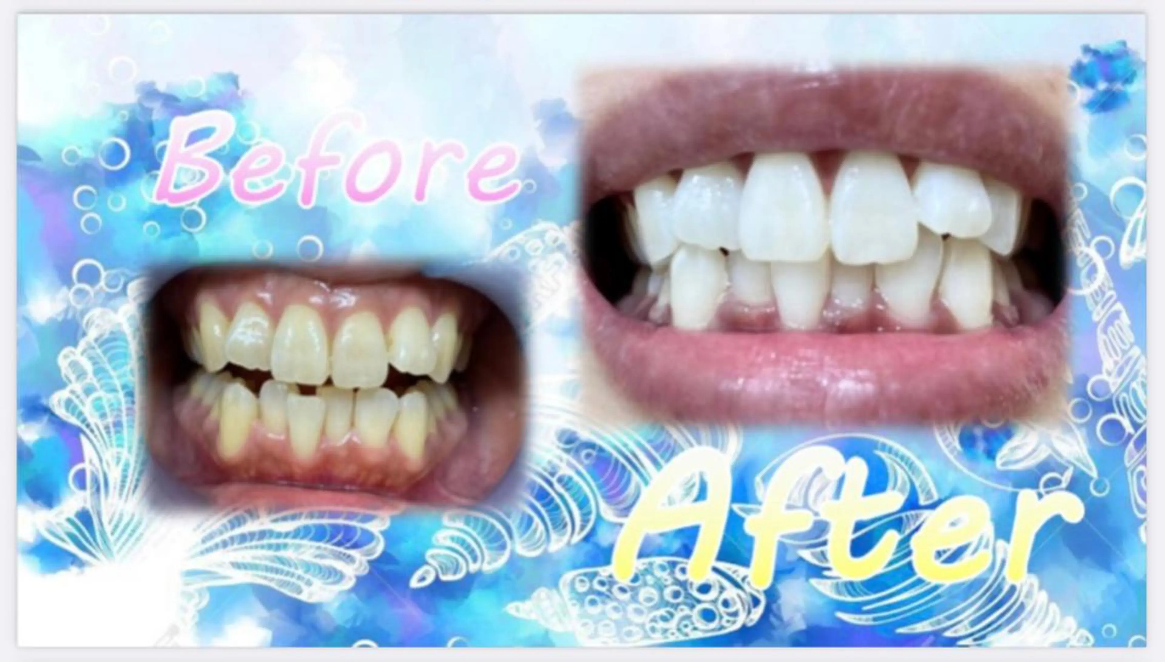 その他 セルフホワイトニングサロン　ラヴィアン所属・ホワイトニングサロン La vie enのその他イメージ