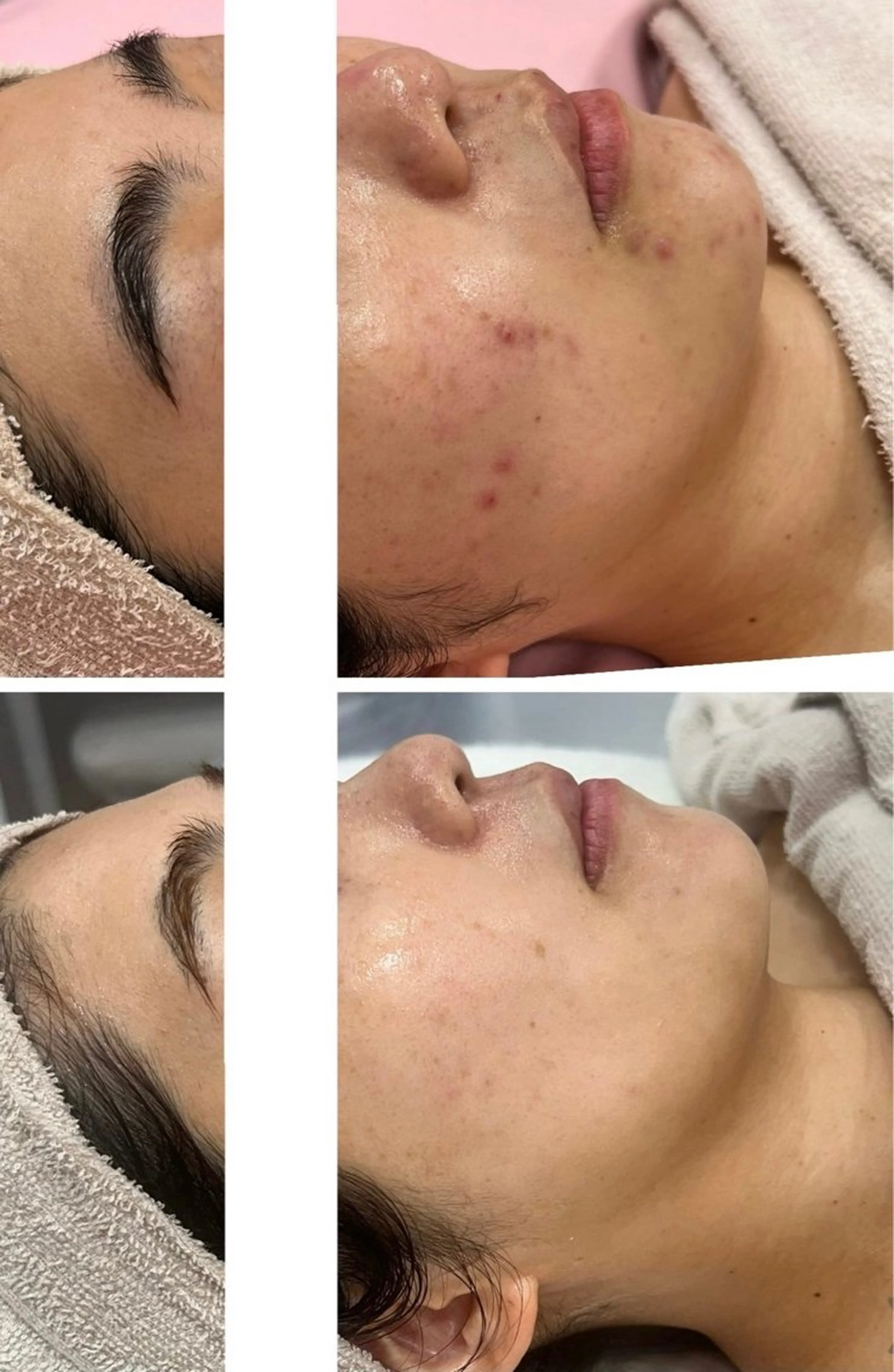 NOAH 小顔毛穴 川越店所属・NOAH ORIEのエステ・リラクイメージ