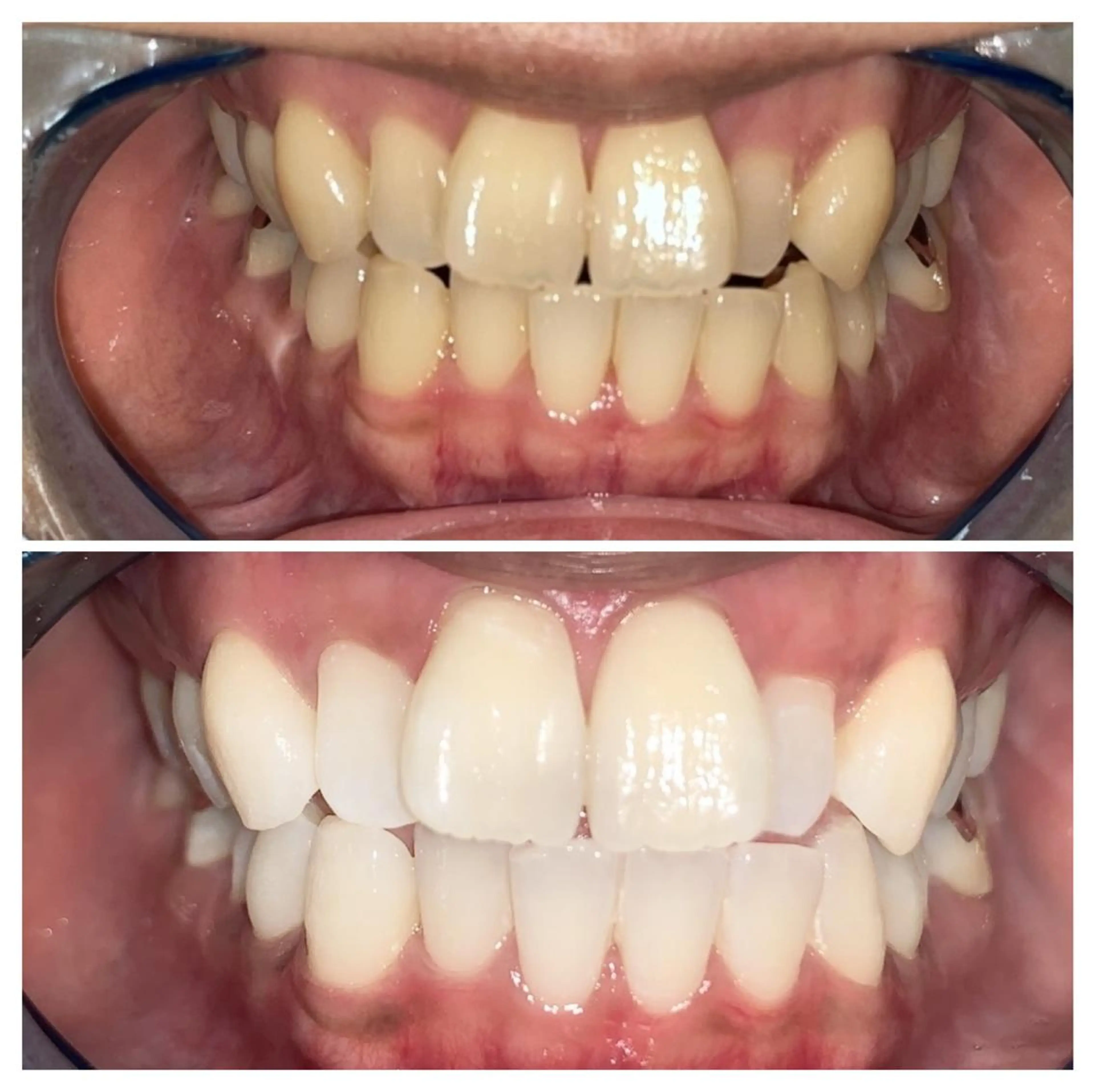 ヘアアレンジ ネイル マツエク・マツパ メンズ カラー パーマ アイブロウ キッズ ショート エステ リラク ライトビューティー 銀座店のエステ・リラクイメージ