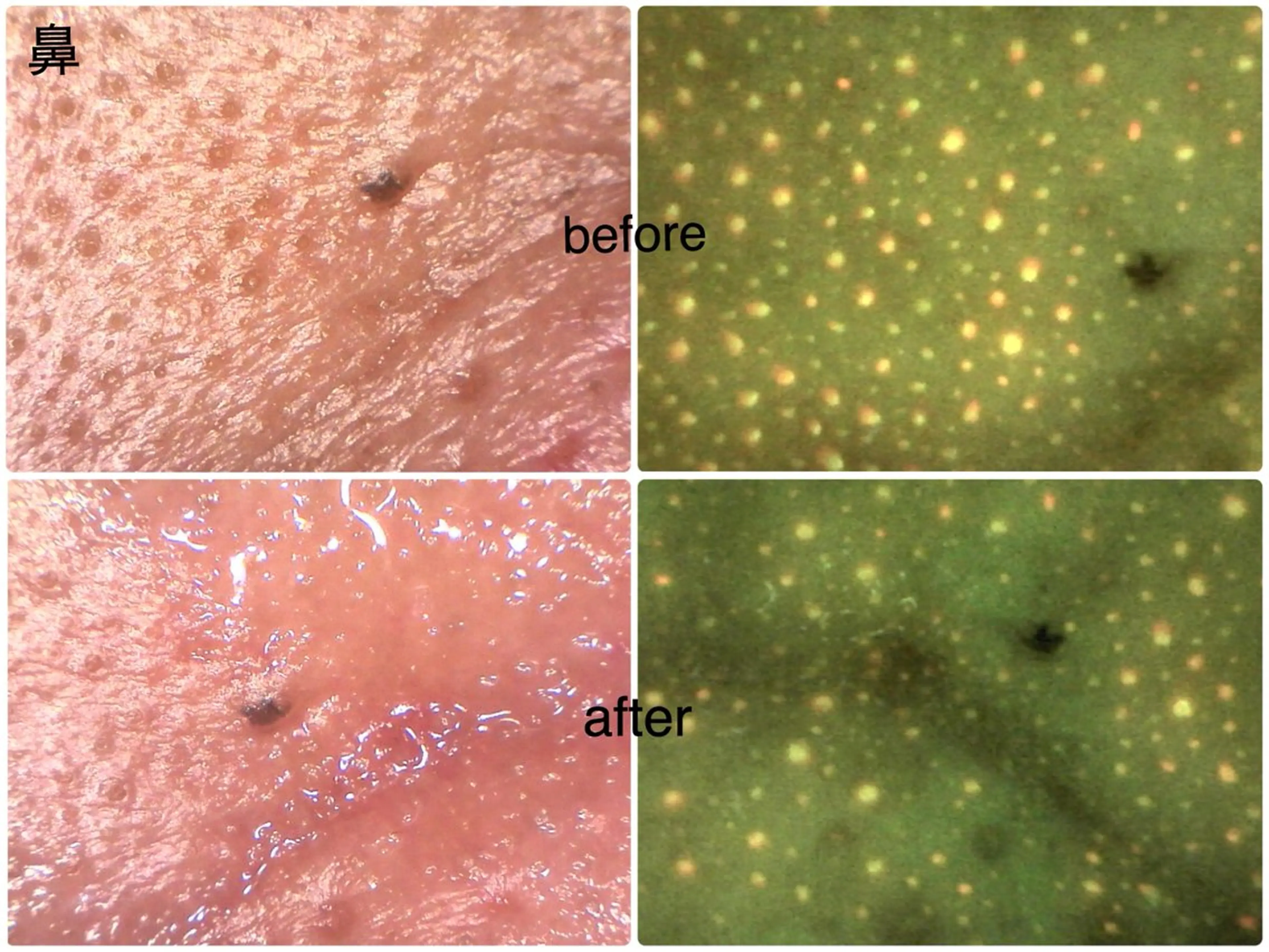 エステ 常光 美羽のエステ・リラクイメージ