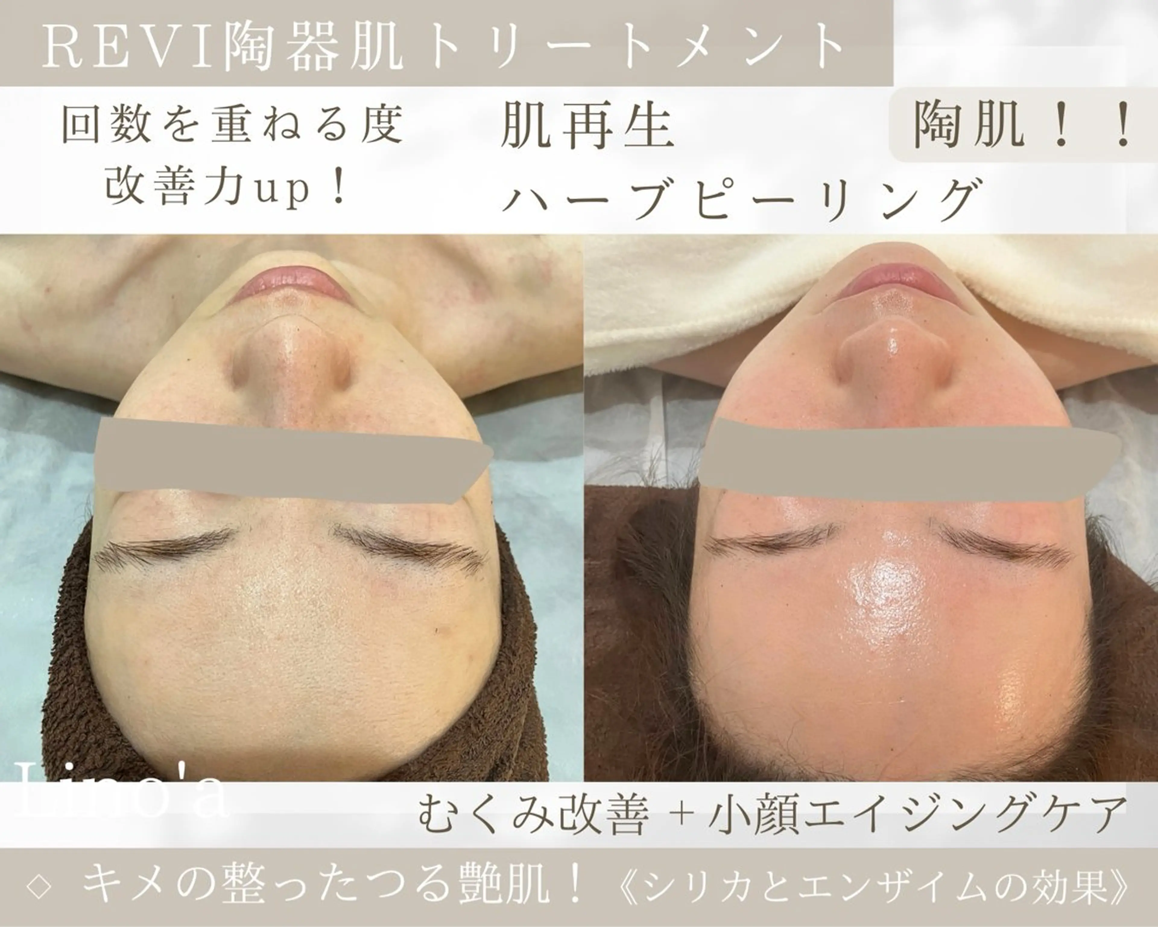 エステ リラク Salon💫 Lino'a柏店のエステ・リラクイメージ