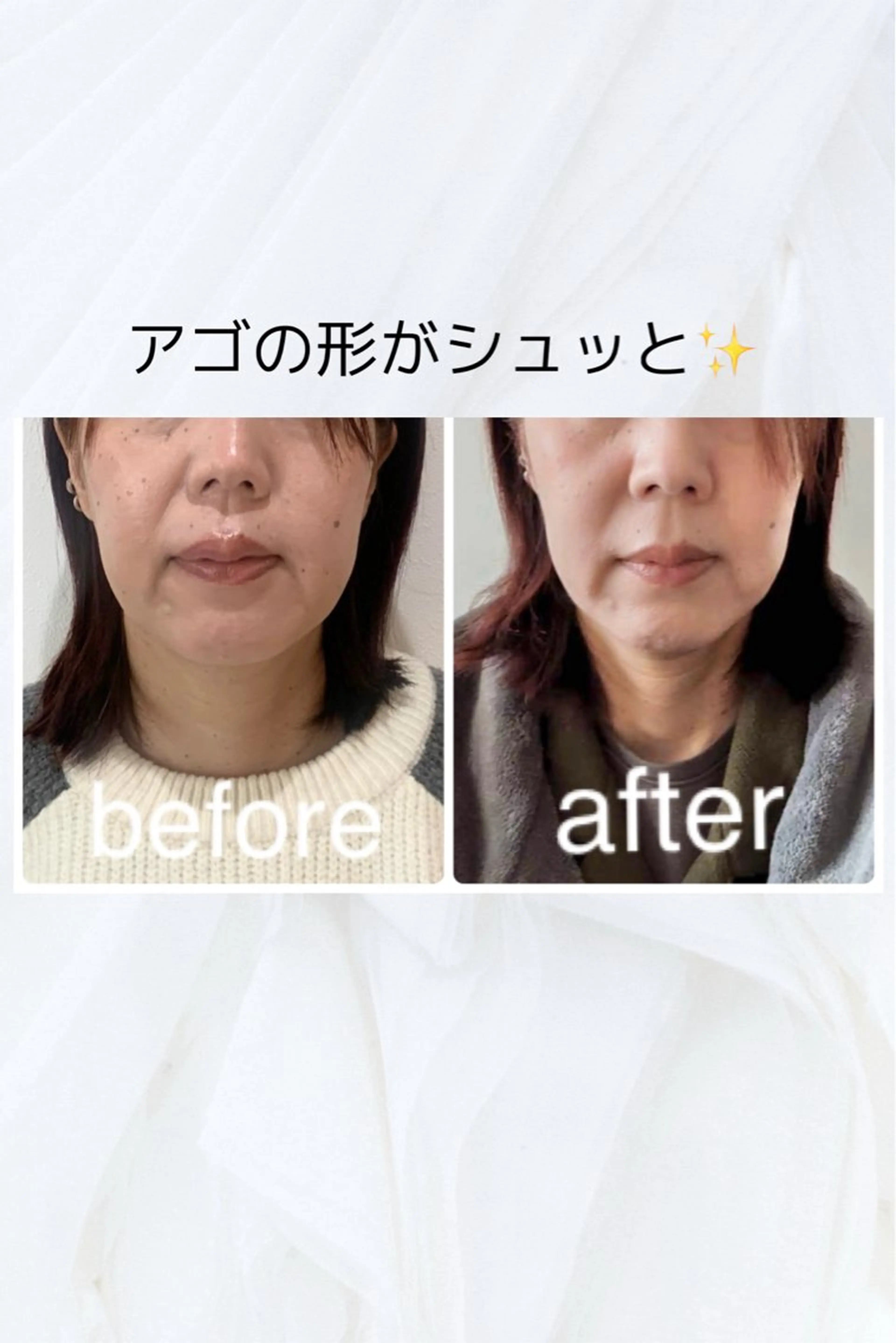 エステ リラク 小顔と ヘッドスパのお店のエステ・リラクイメージ