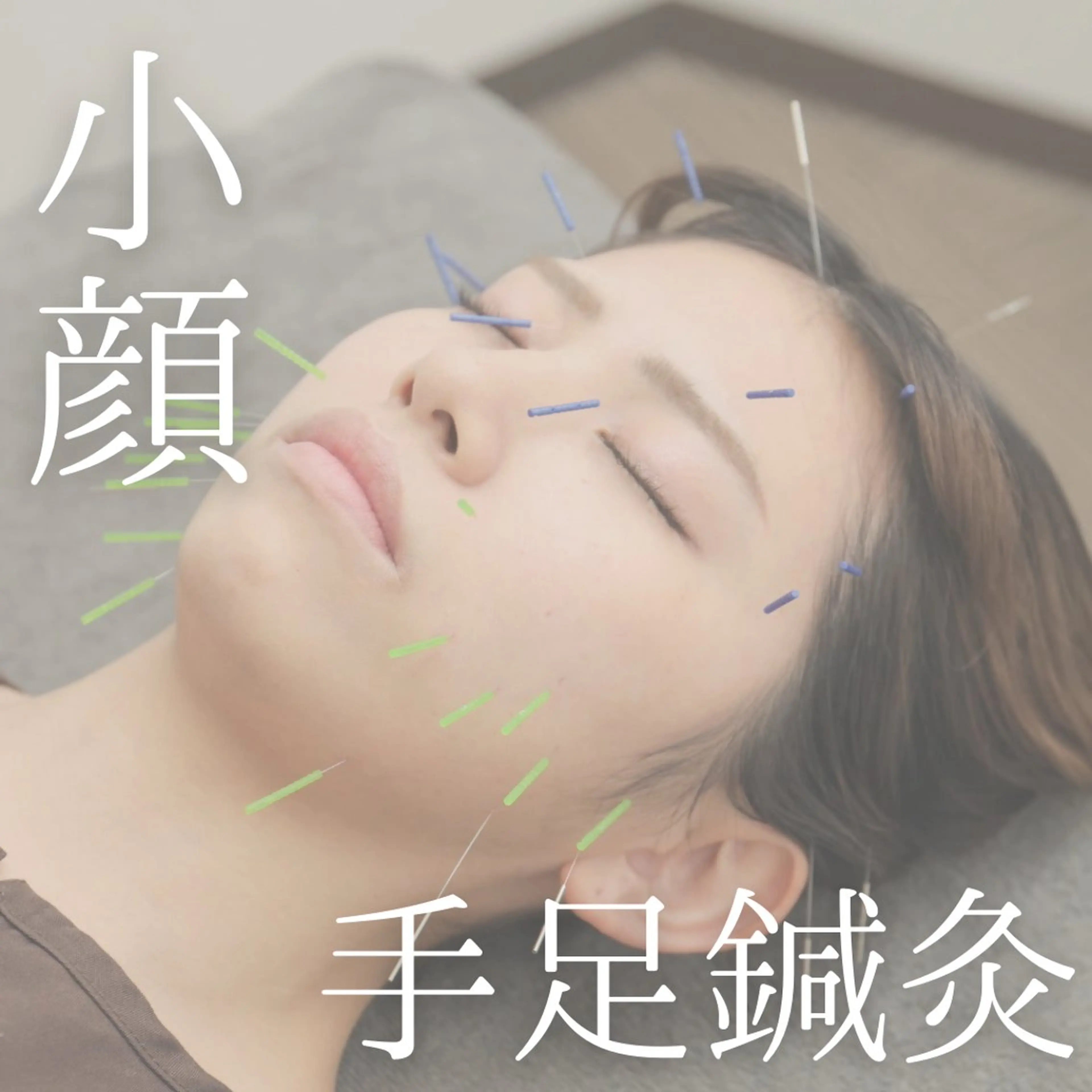 【美容鍼＋手足鍼灸＋小顔矯正🪡❤️60分】初回のみ別途カウンセリング30分/お時間の余裕を持ってご来店ください☺️の写真