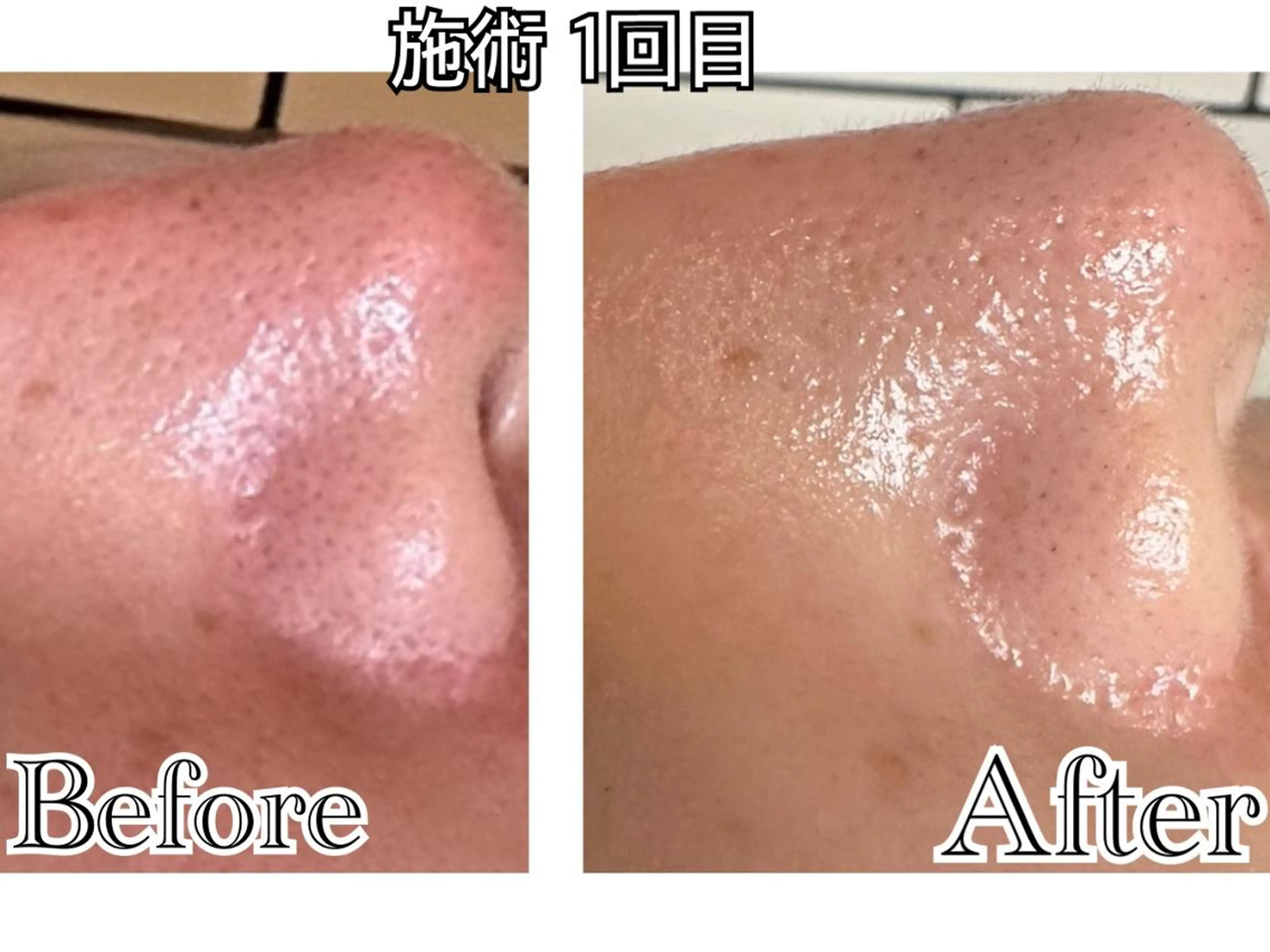 エステ リラク salon SHE° 新宿店🩵のその他イメージ