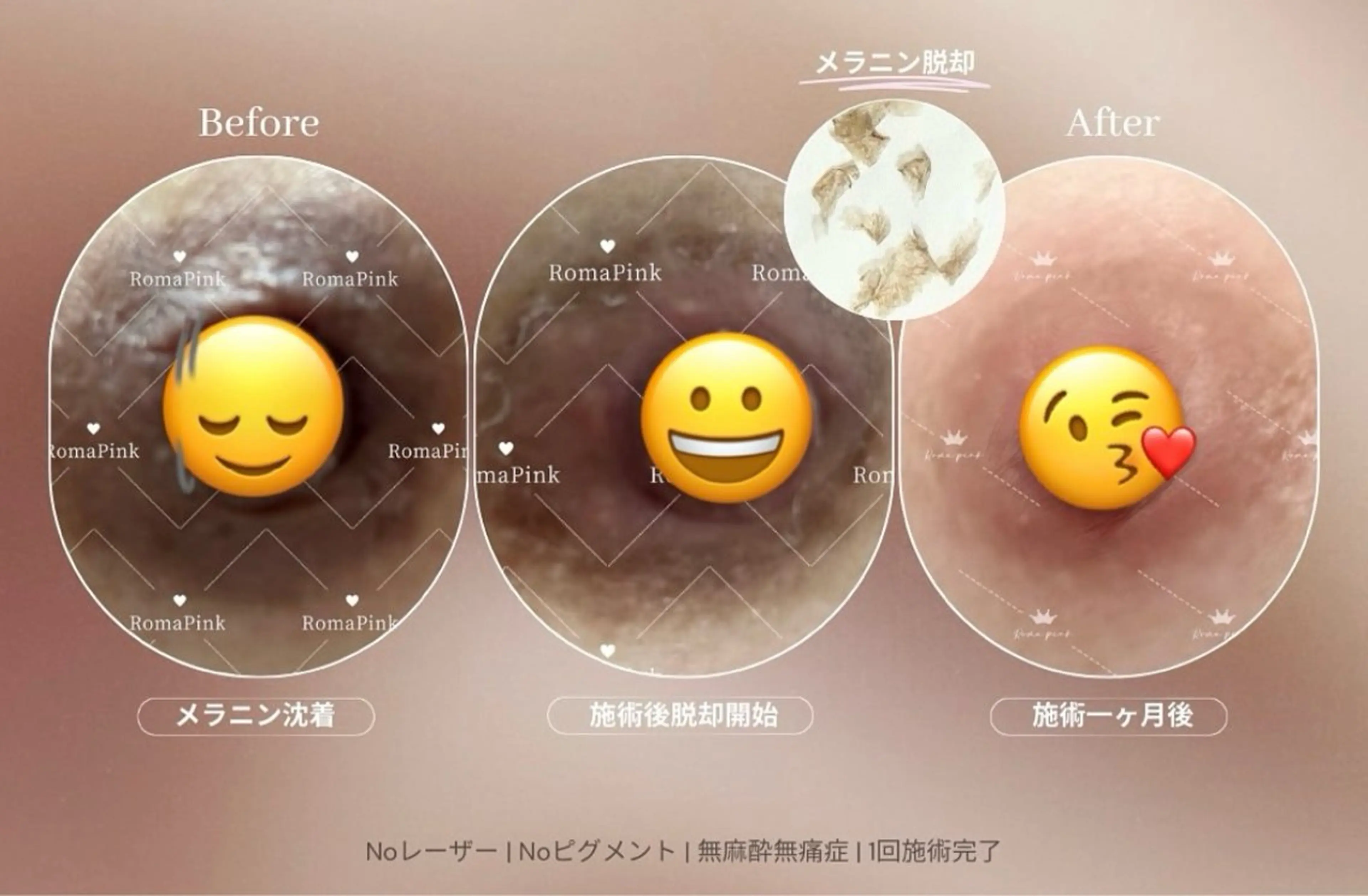 小顔/たるみ/黒ずみ除去専門サロン/SONA 大和西大寺店所属・【小顔専門看護師 サロンSONA】のエステ・リラクイメージ