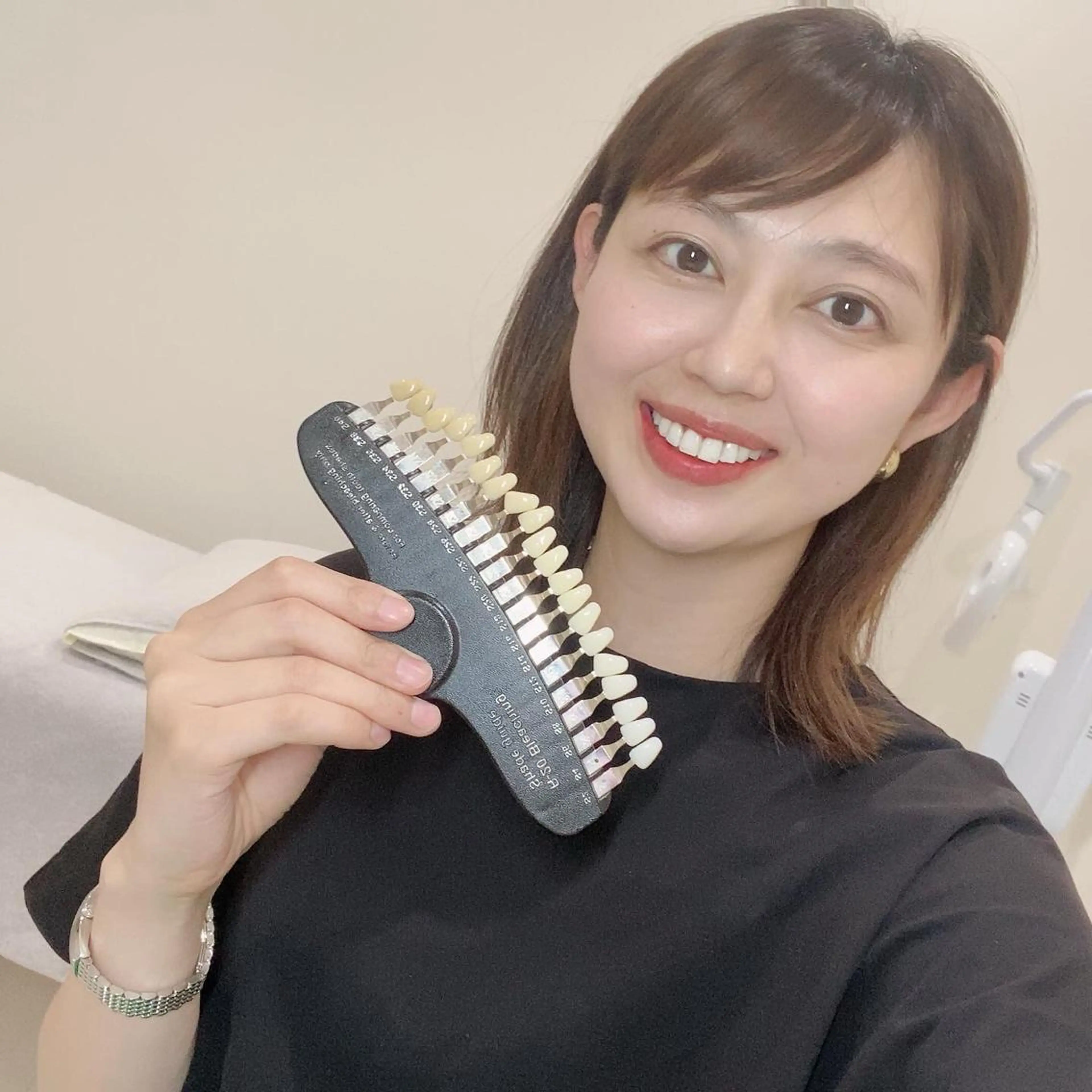 White Berry SELF BEAUTY SALON所属・セルフホワイトニング 🦷口元垢抜け✨のその他イメージ