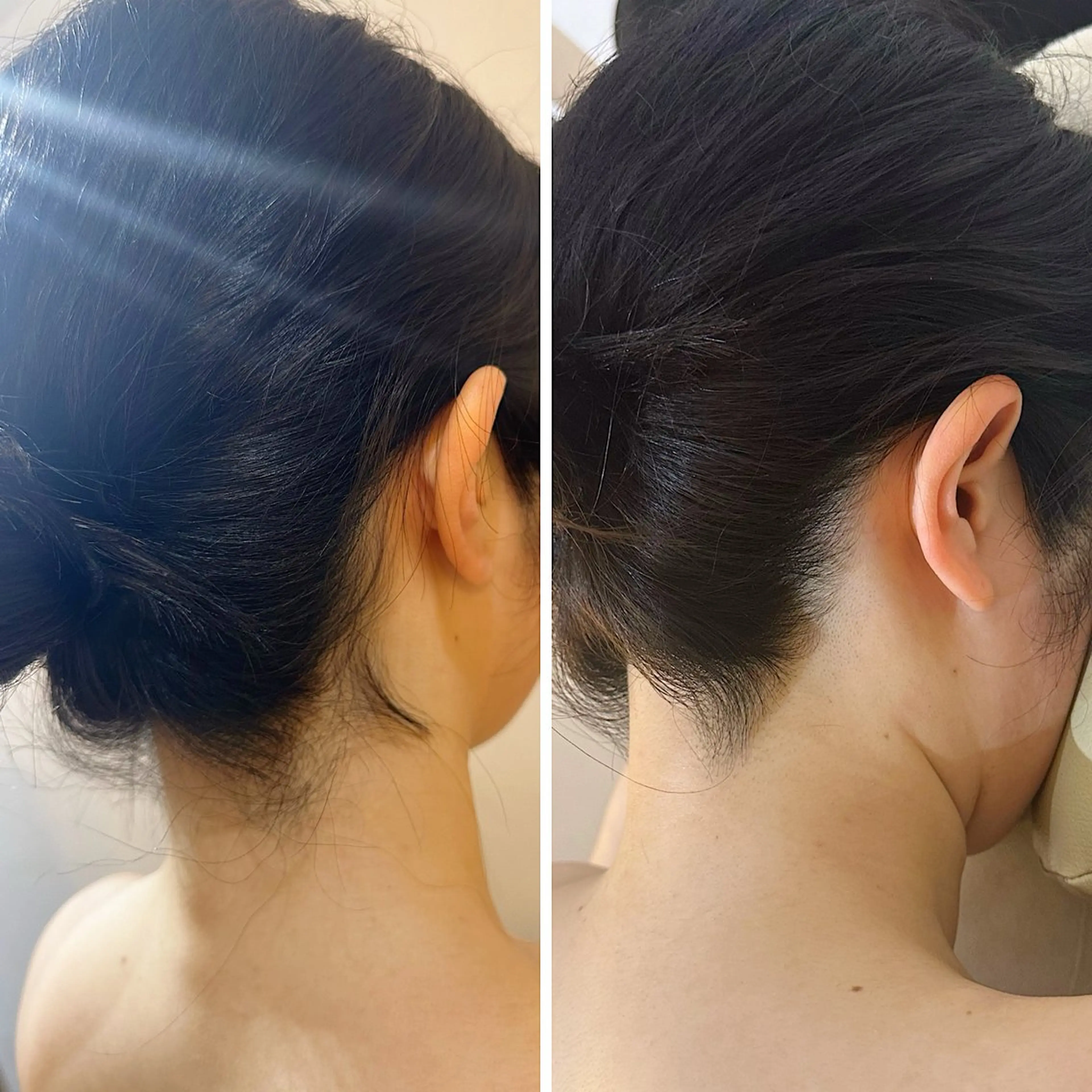 脱毛 うなじ脱毛/美肌脱毛 LABELのエステ・リラクイメージ