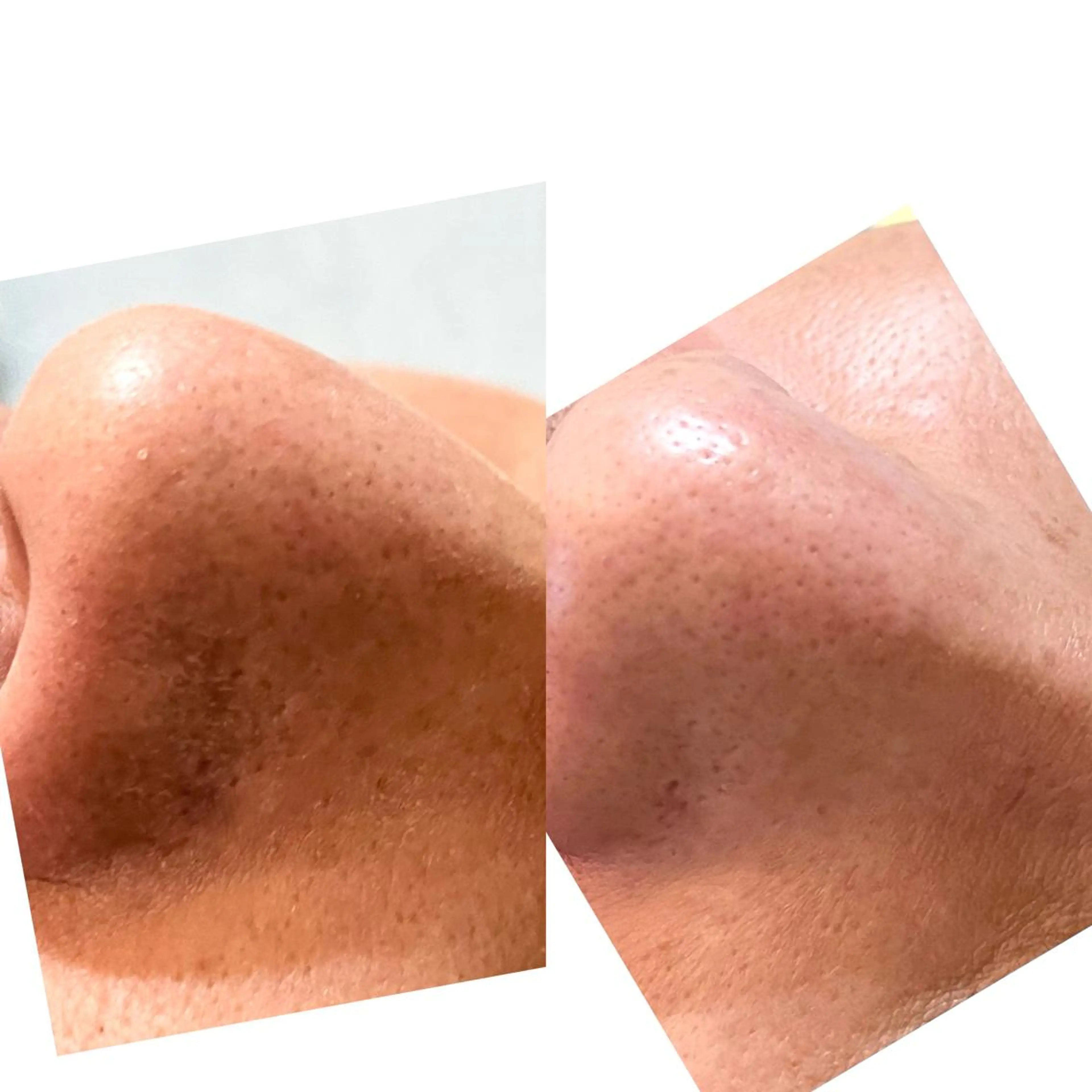 おうちサロン B-ROOMのエステ・リラクイメージ