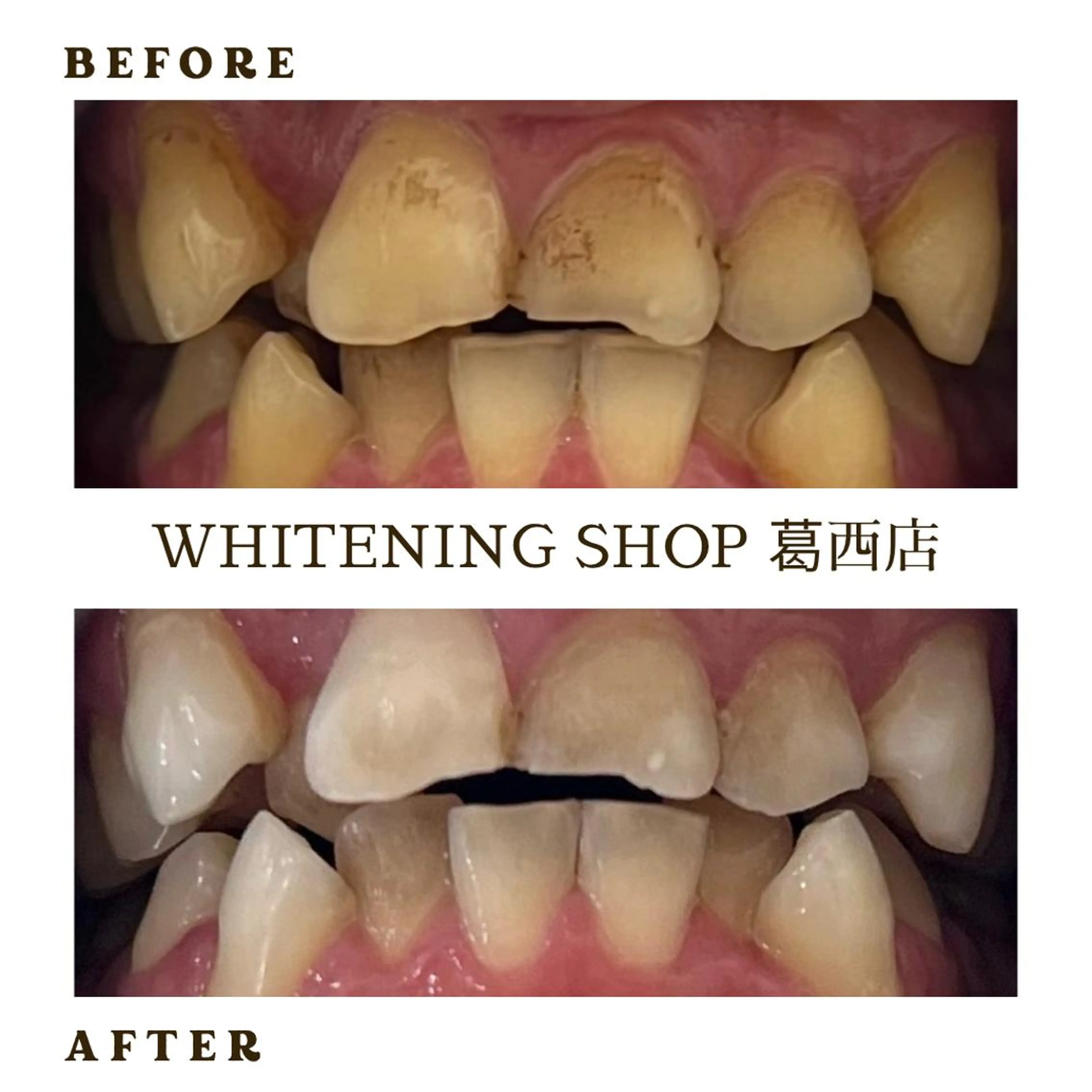 メンズ ホワイトニング ショップ葛西店のその他イメージ