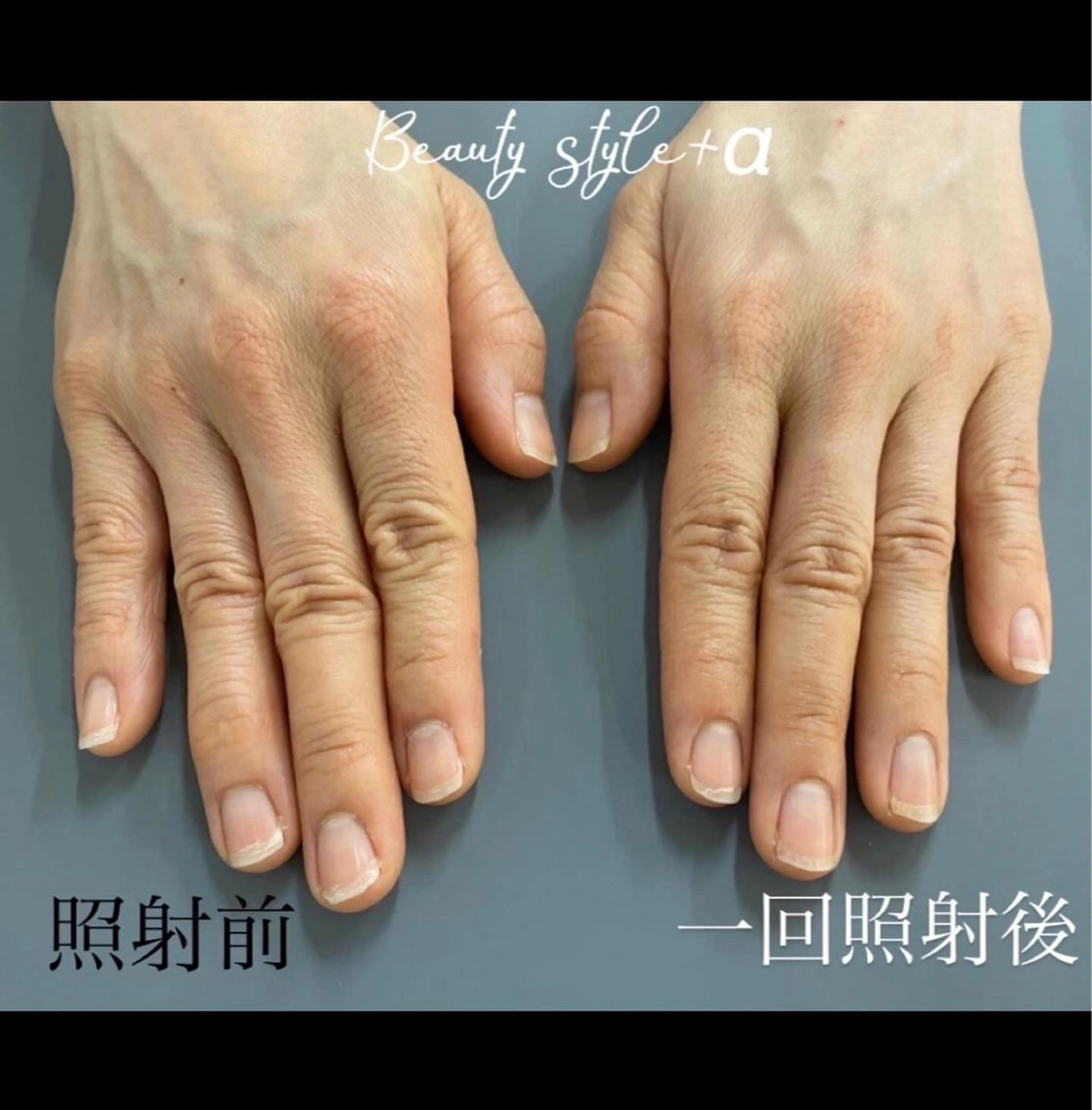 ネイル Beauty style +α所属・Memezawa Nanaのネイルデザイン