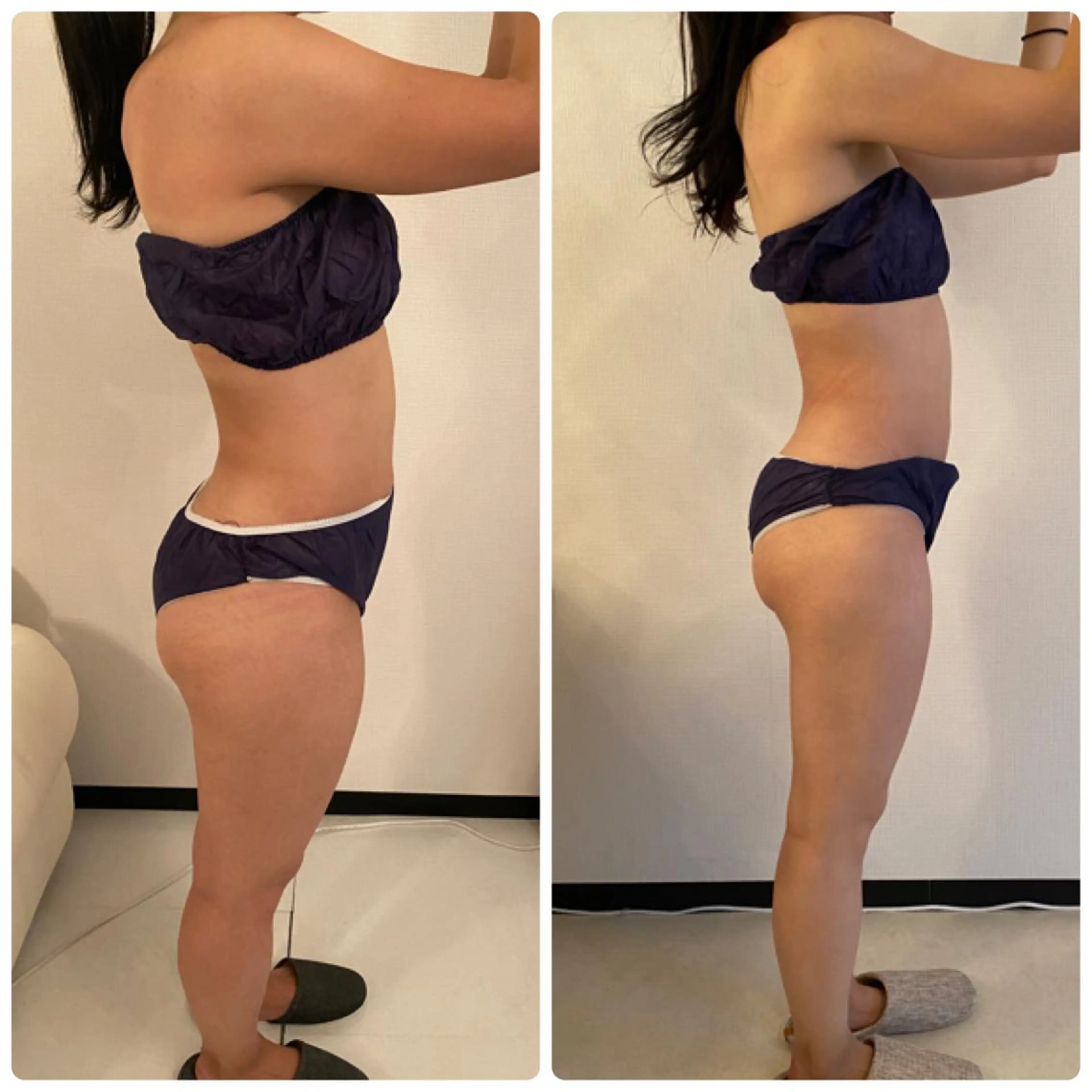 FLEUR大阪・整体 ・ハイフ・痩身・小顔のエステ・リラクイメージ