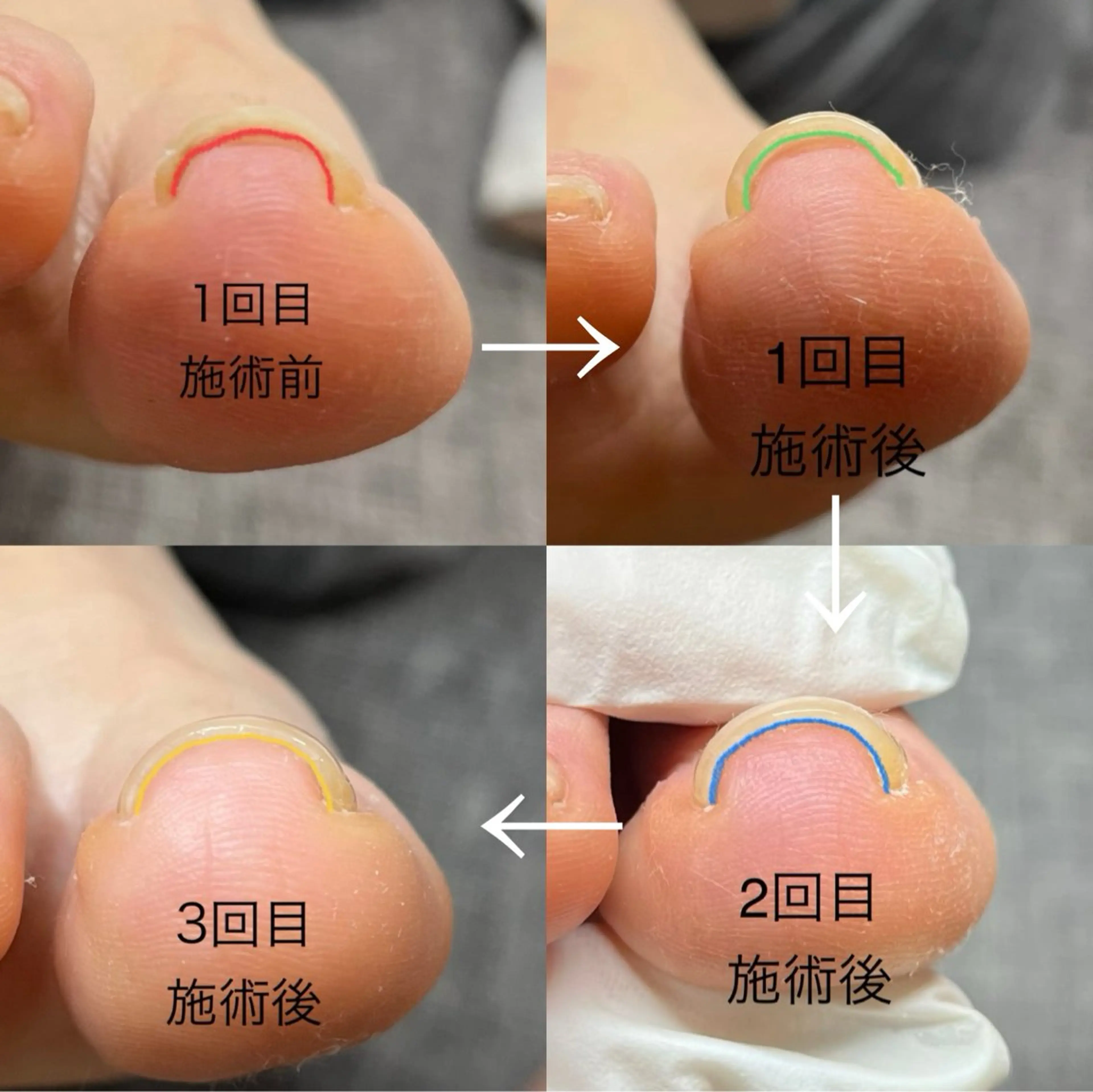 ネイル フットネイル ジェルネイル HUU.所属・HUU. riko 二俣川のネイルデザイン