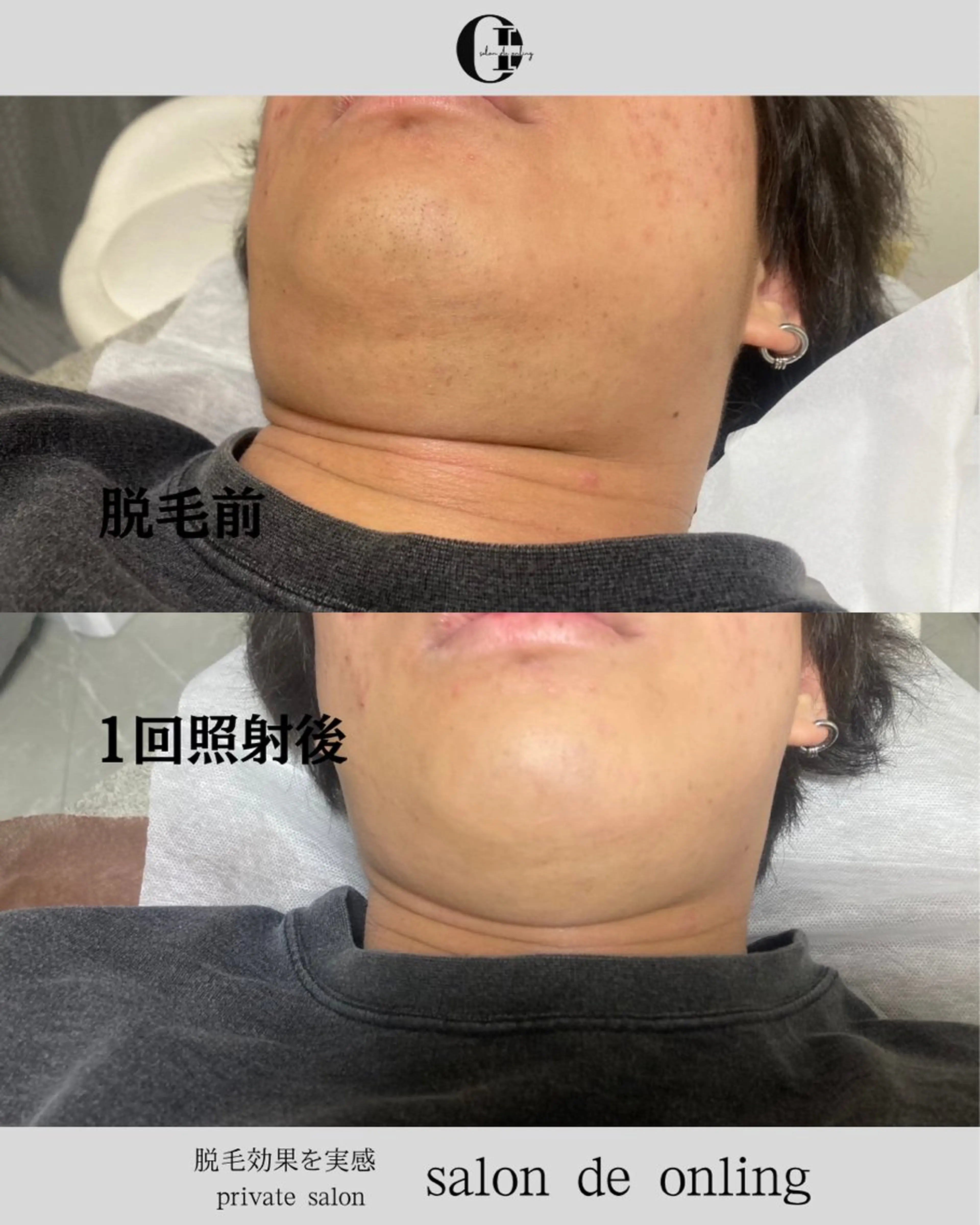 脱毛 salon  de onlingのエステ・リラクイメージ