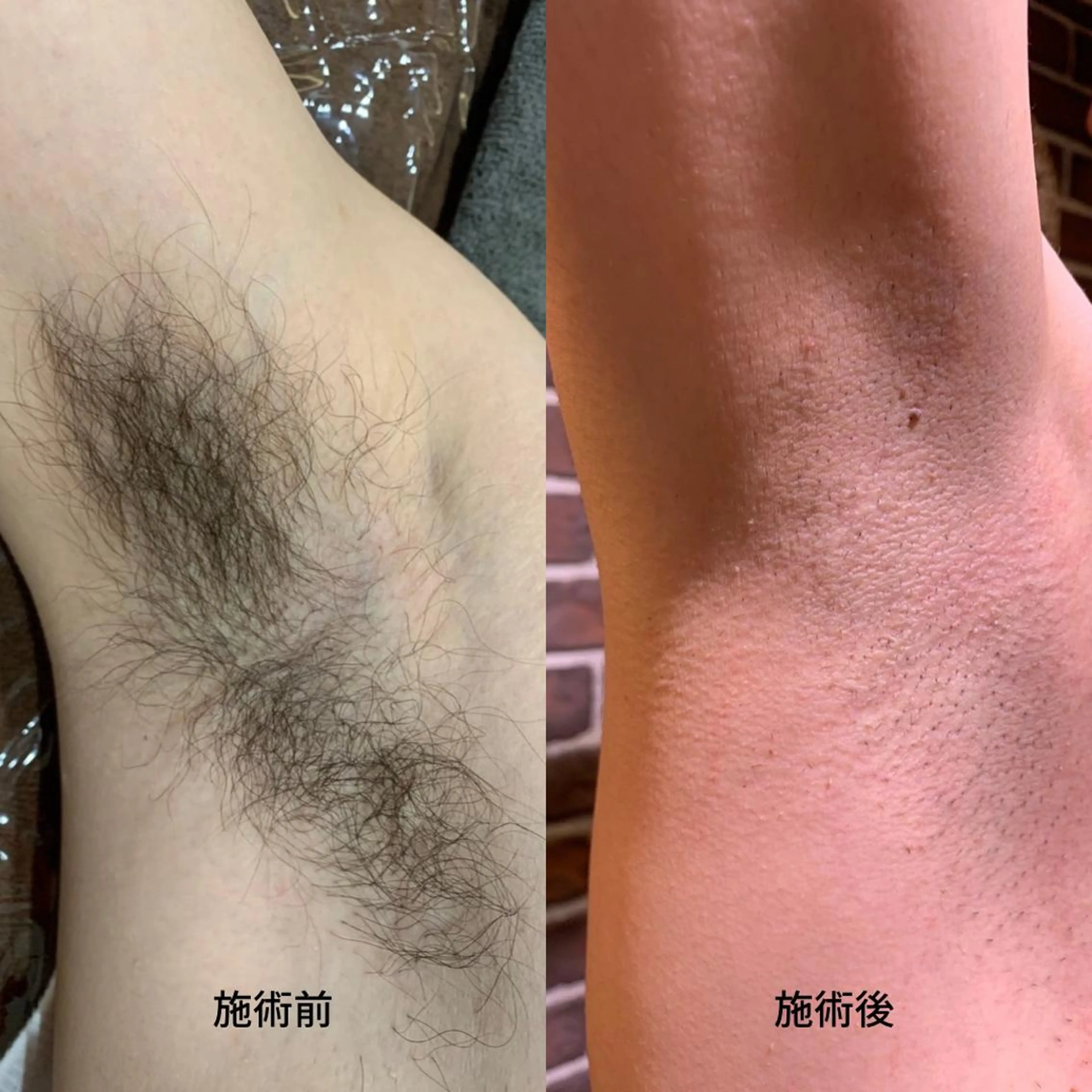 脱毛 DUPE&MORE所属・DUPE&MORE 店長kanaeのエステ・リラクイメージ