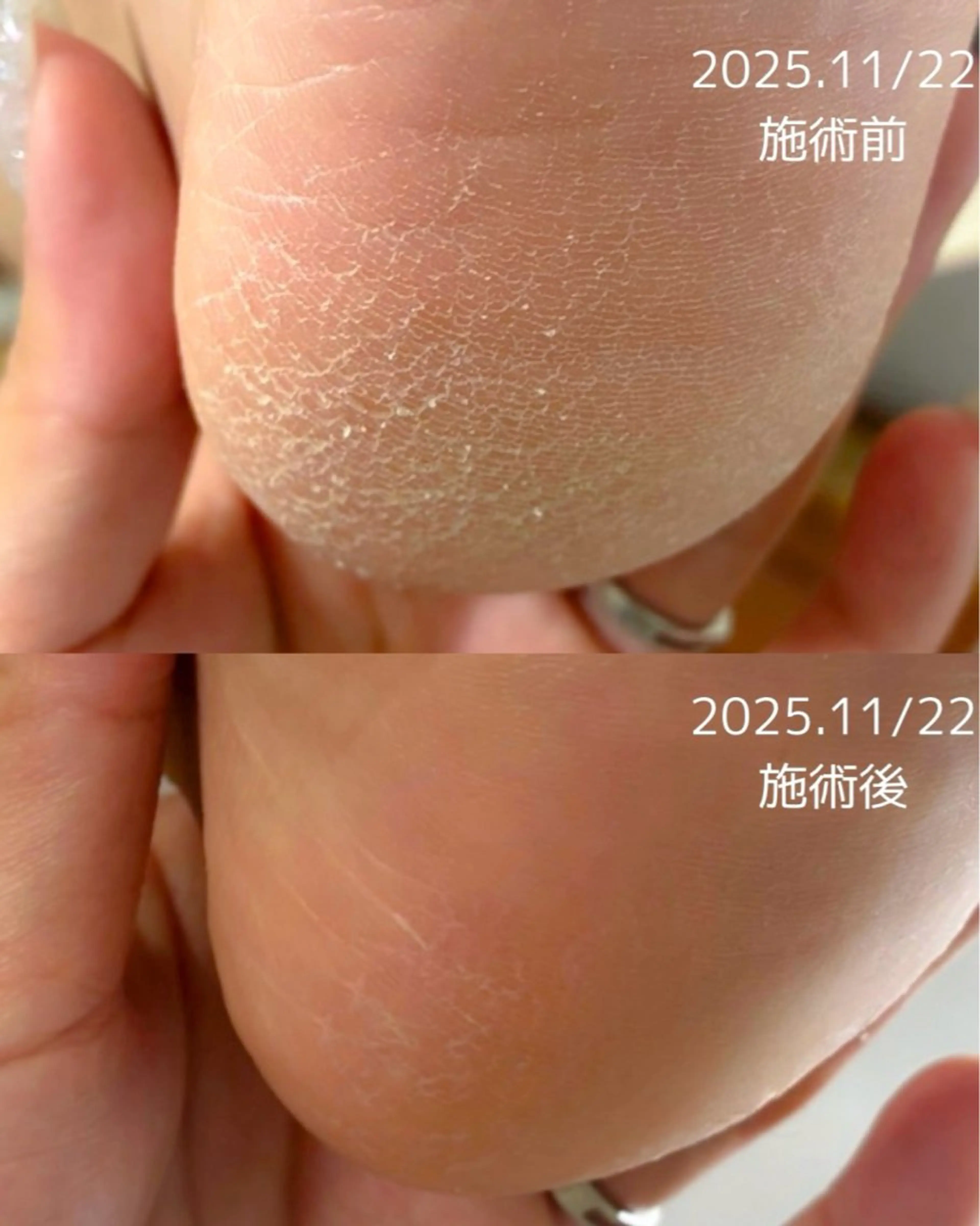 Li.m nail リム ネイルのネイルデザイン