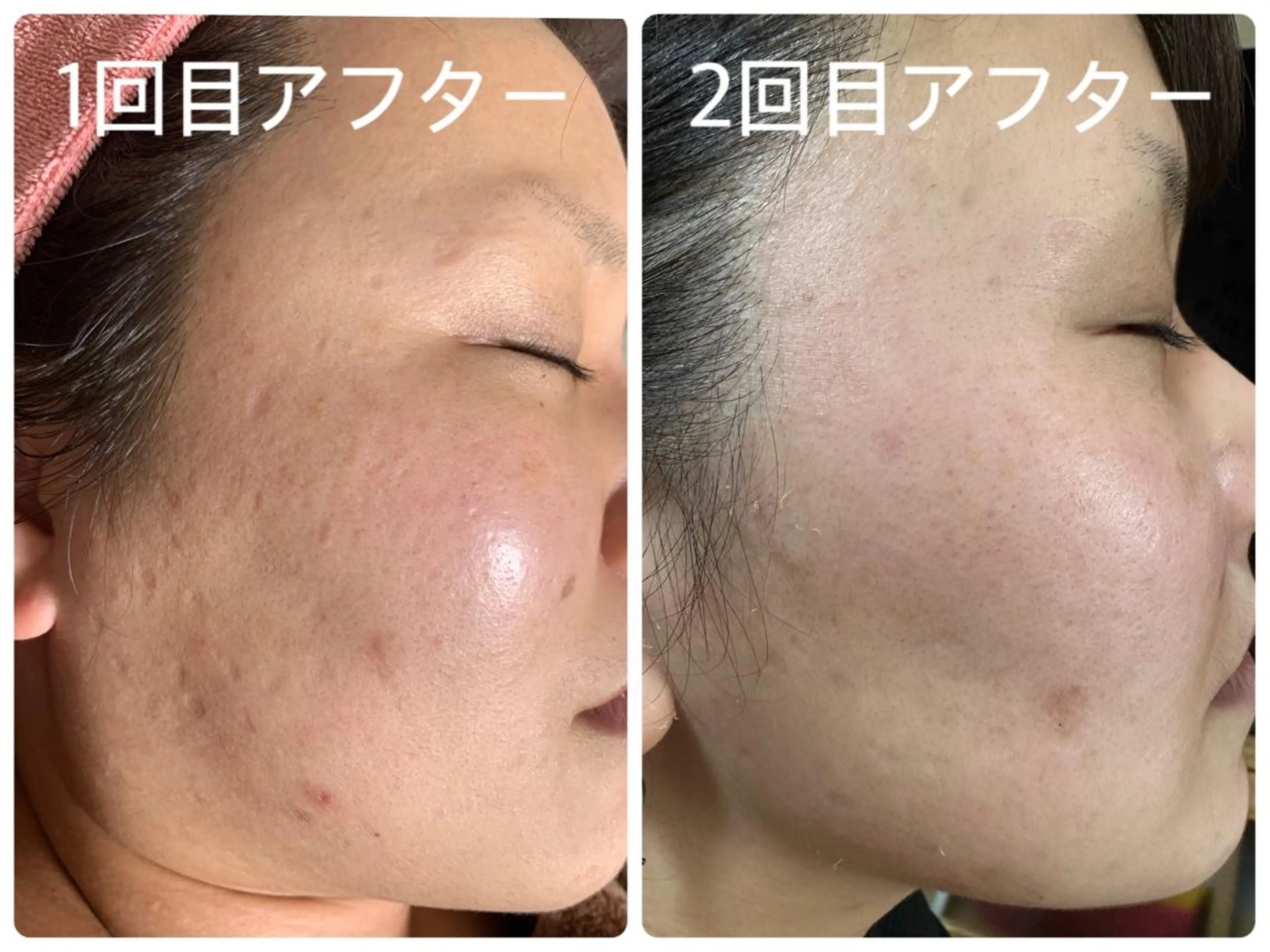 エステ デトックス専門サロン ココシュエットのエステ・リラクイメージ