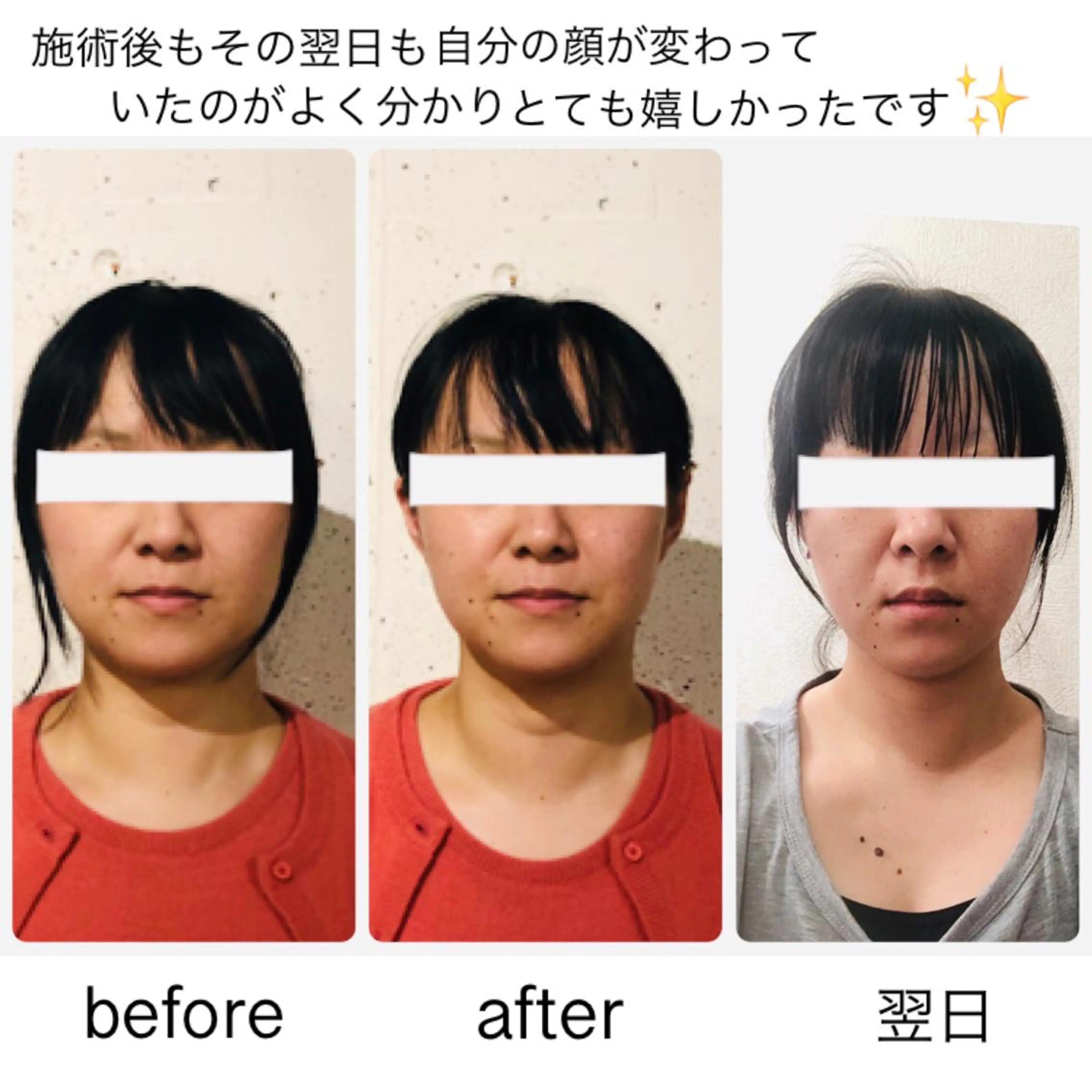 ミディアム ネイル マツエク・マツパ 小顔矯正専門サロンジュマリ所属・町田 淳子のエステ・リラクイメージ