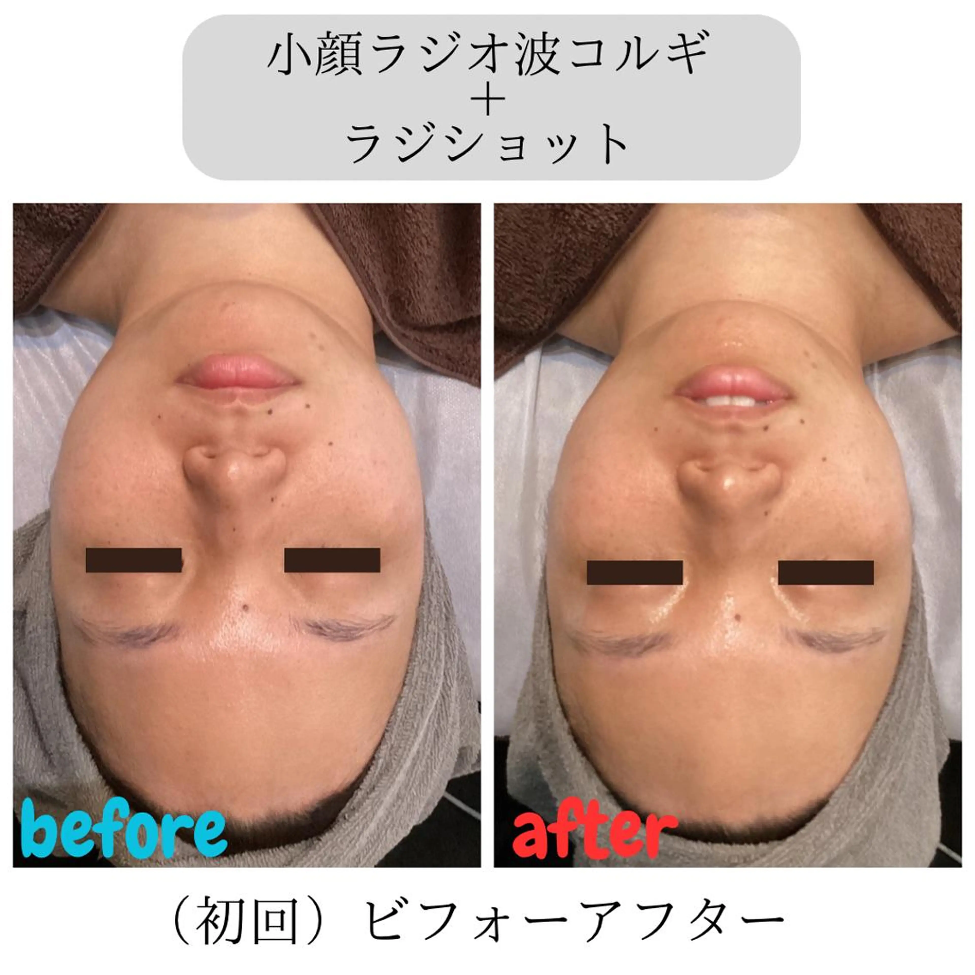 エステ Babel kumiのエステ・リラクイメージ