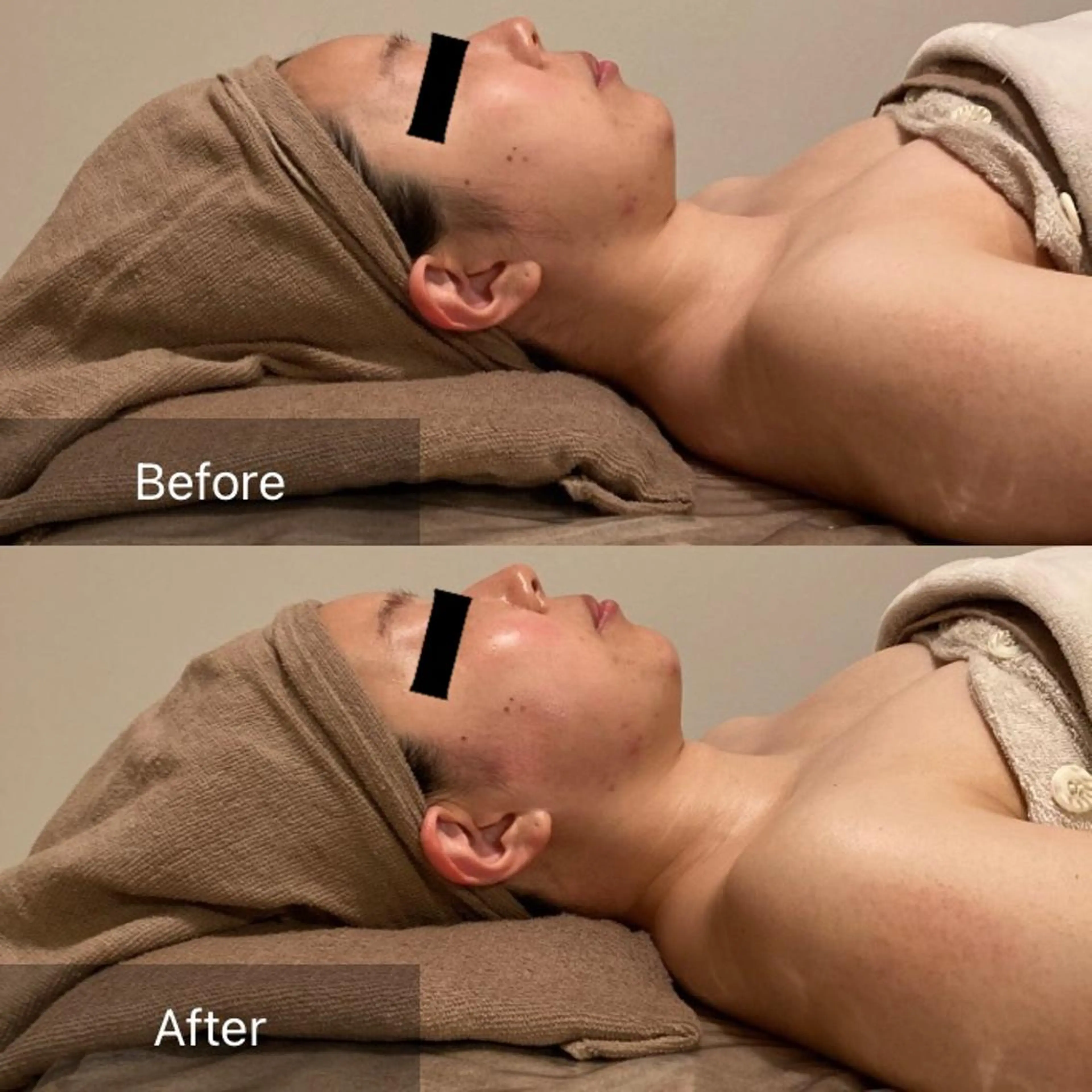 Ｂ&H所属・頭痛•肩こり専門/ 眉サロンB&H心斎橋のエステ・リラクイメージ