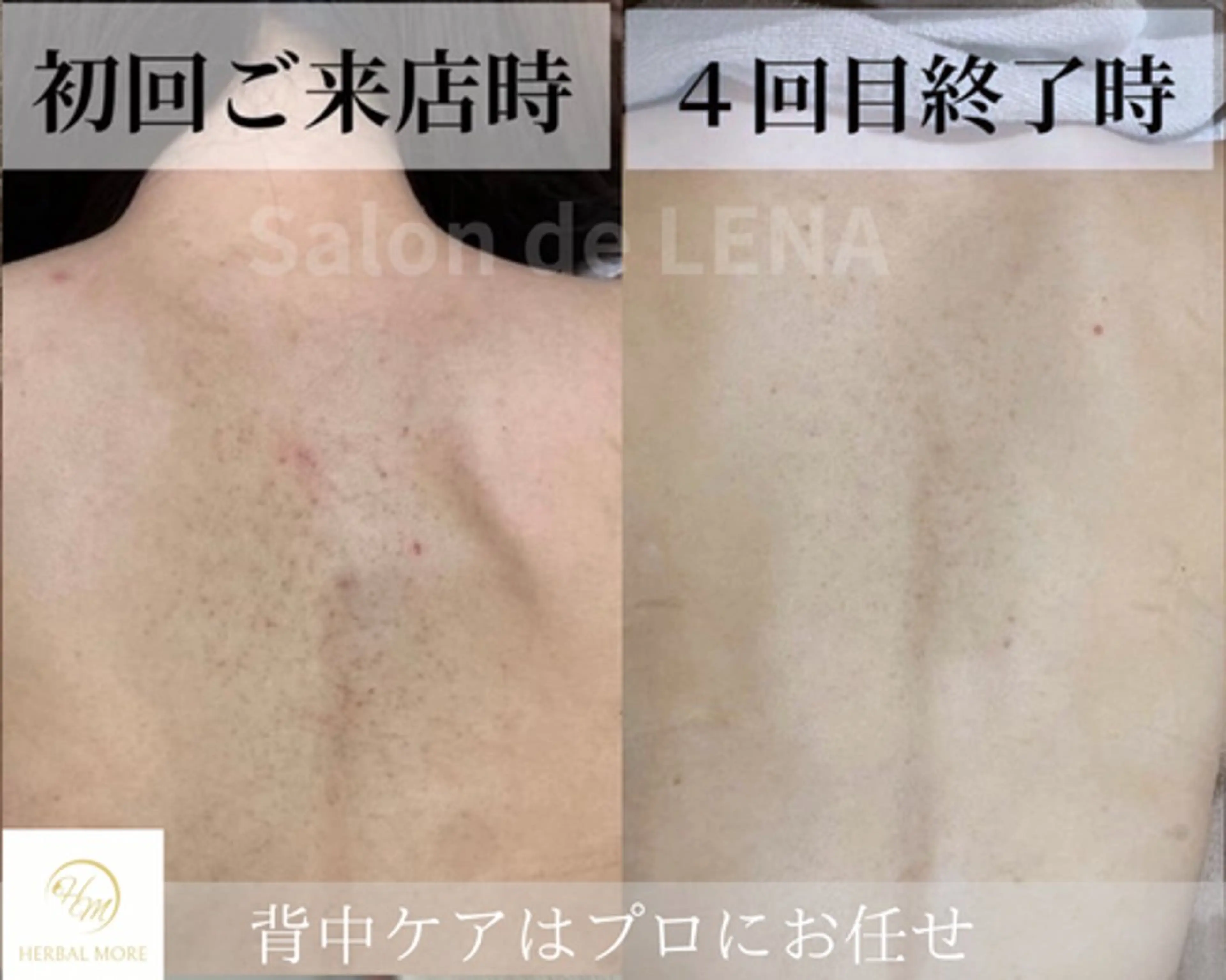 エステ サロンドレナ名駅店所属・ハーブピーリング専門 サロンドレナ平岡のエステ・リラクイメージ