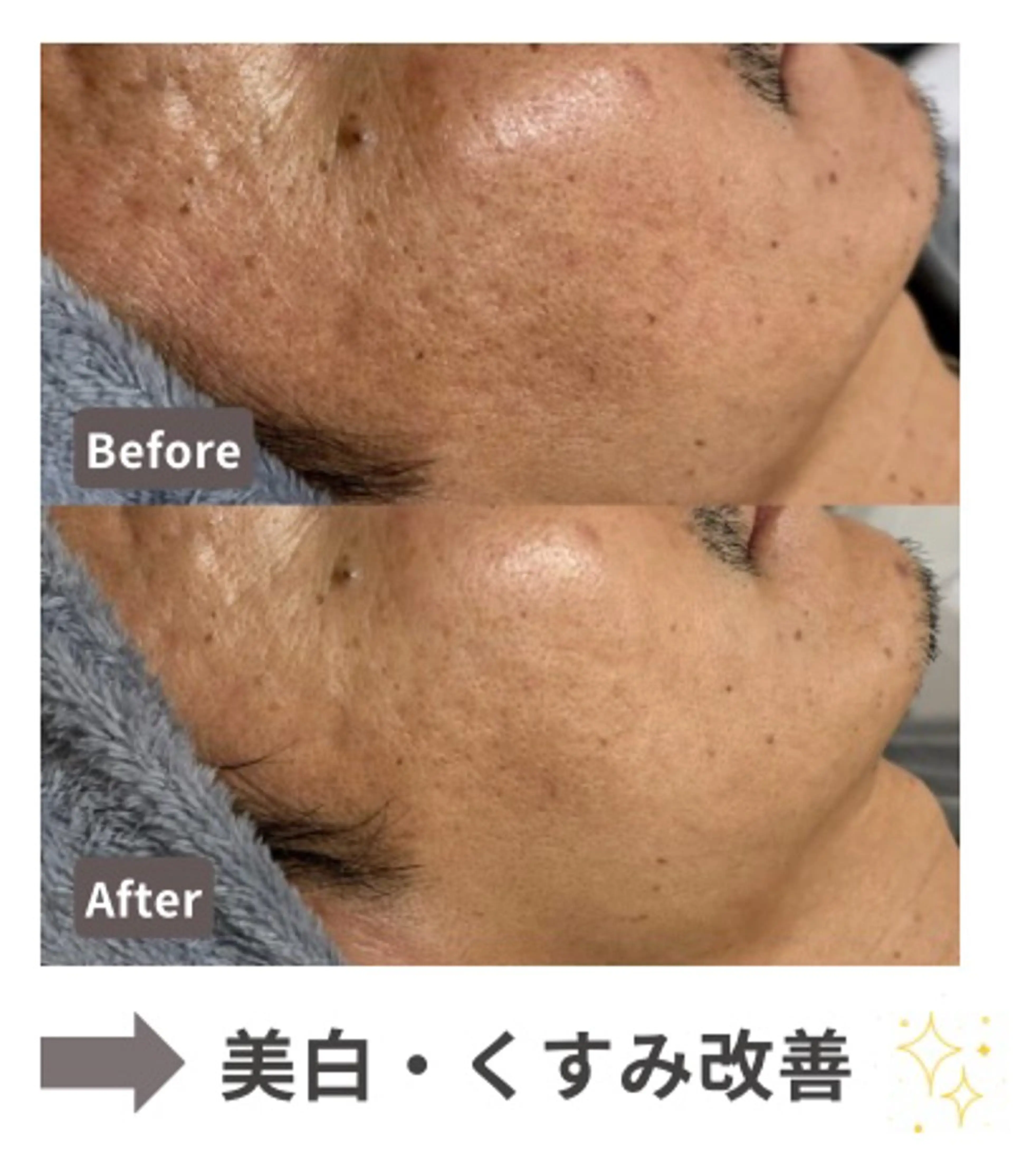 エイジングケア専門 Ponolaのエステ・リラクイメージ