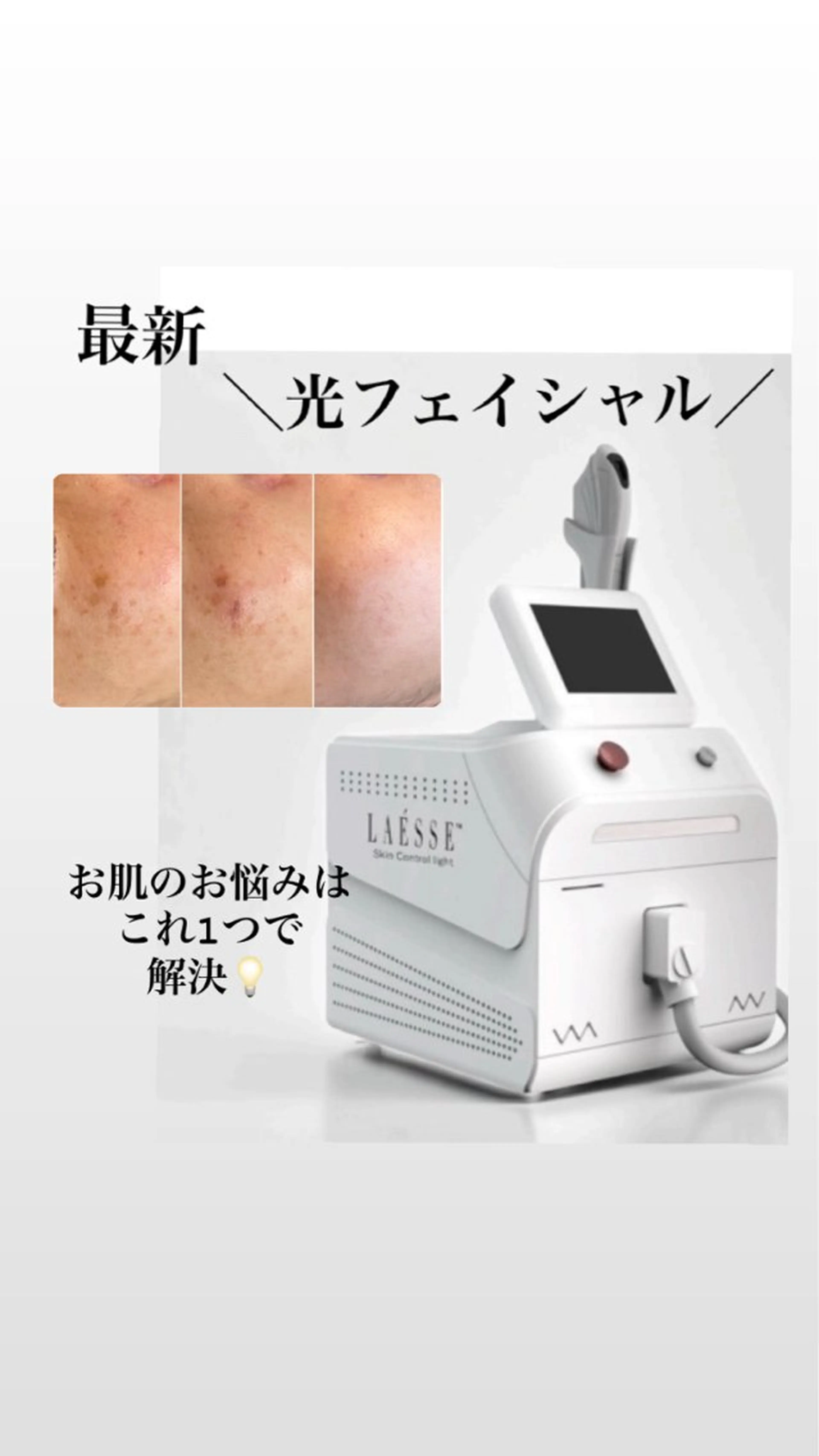 脇脱毛◇痛み×肌負担を抑えた最新脱毛！数分で完了◎の写真