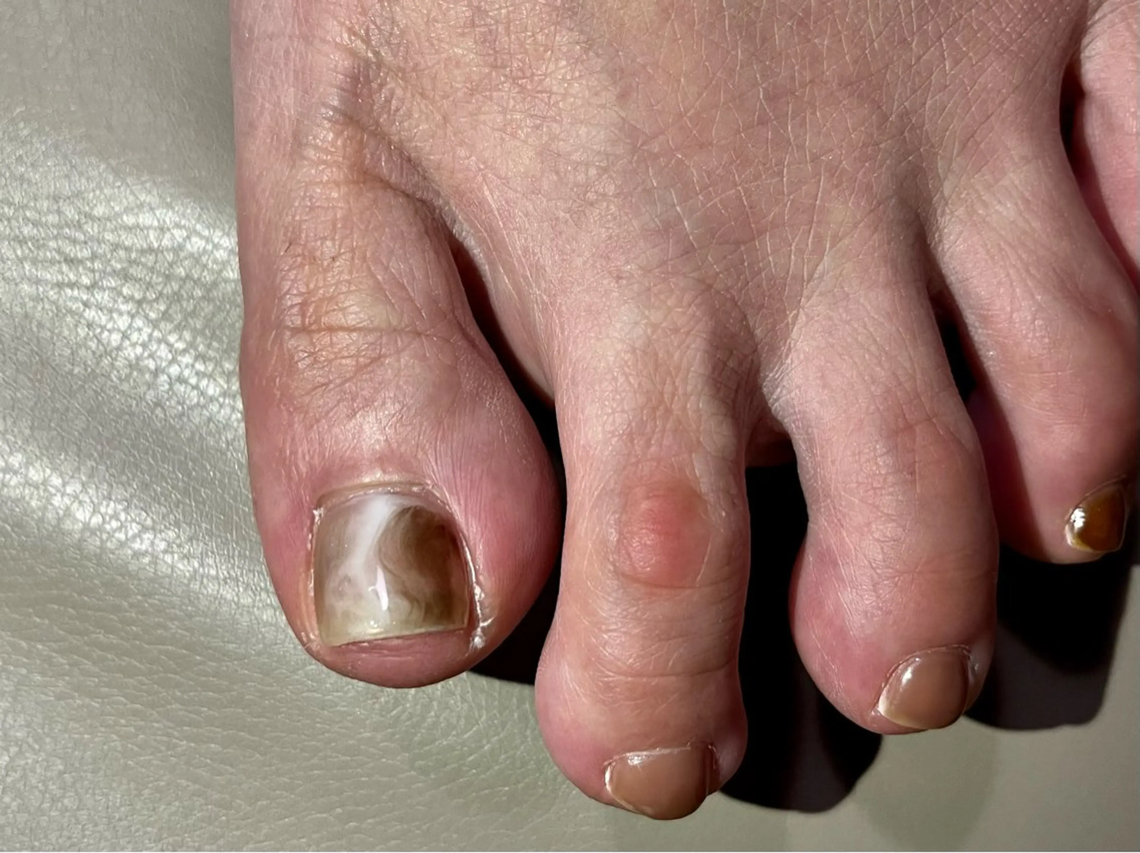 ネイル フットネイル ニュアンスネイル フットネイル kupu所属・ネイルサロン kupuのネイルデザイン