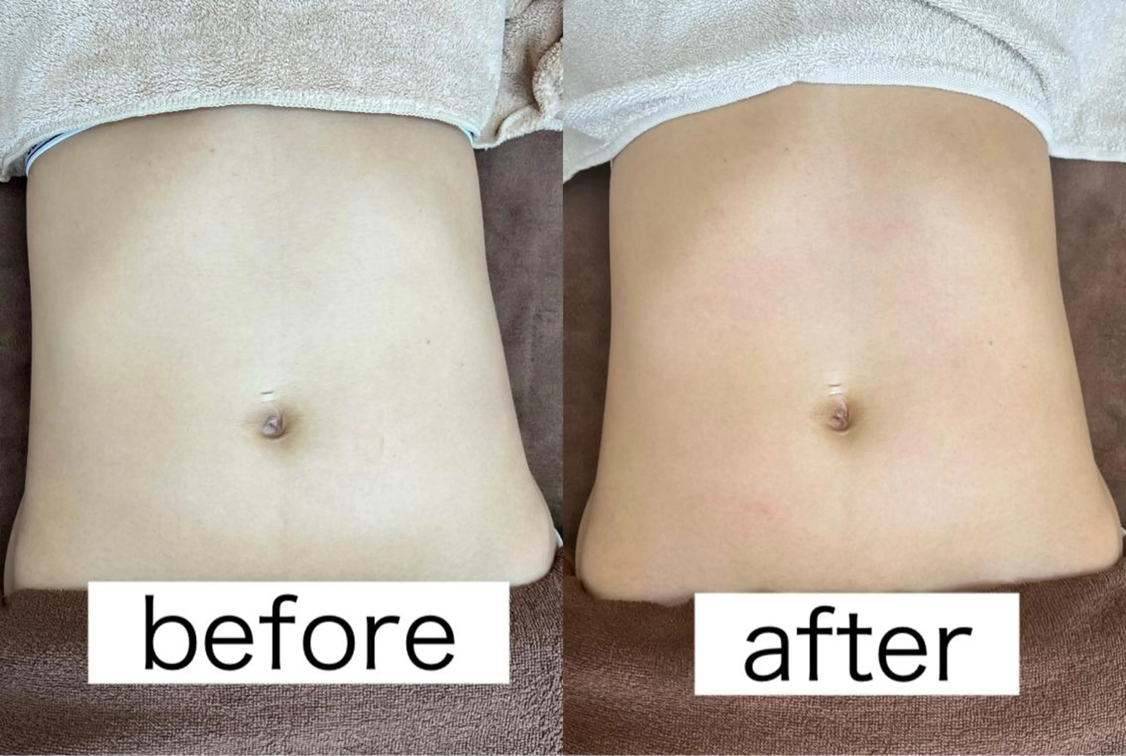 Beauty   Salon  Adiy所属・Adiy ikumiのエステ・リラクイメージ