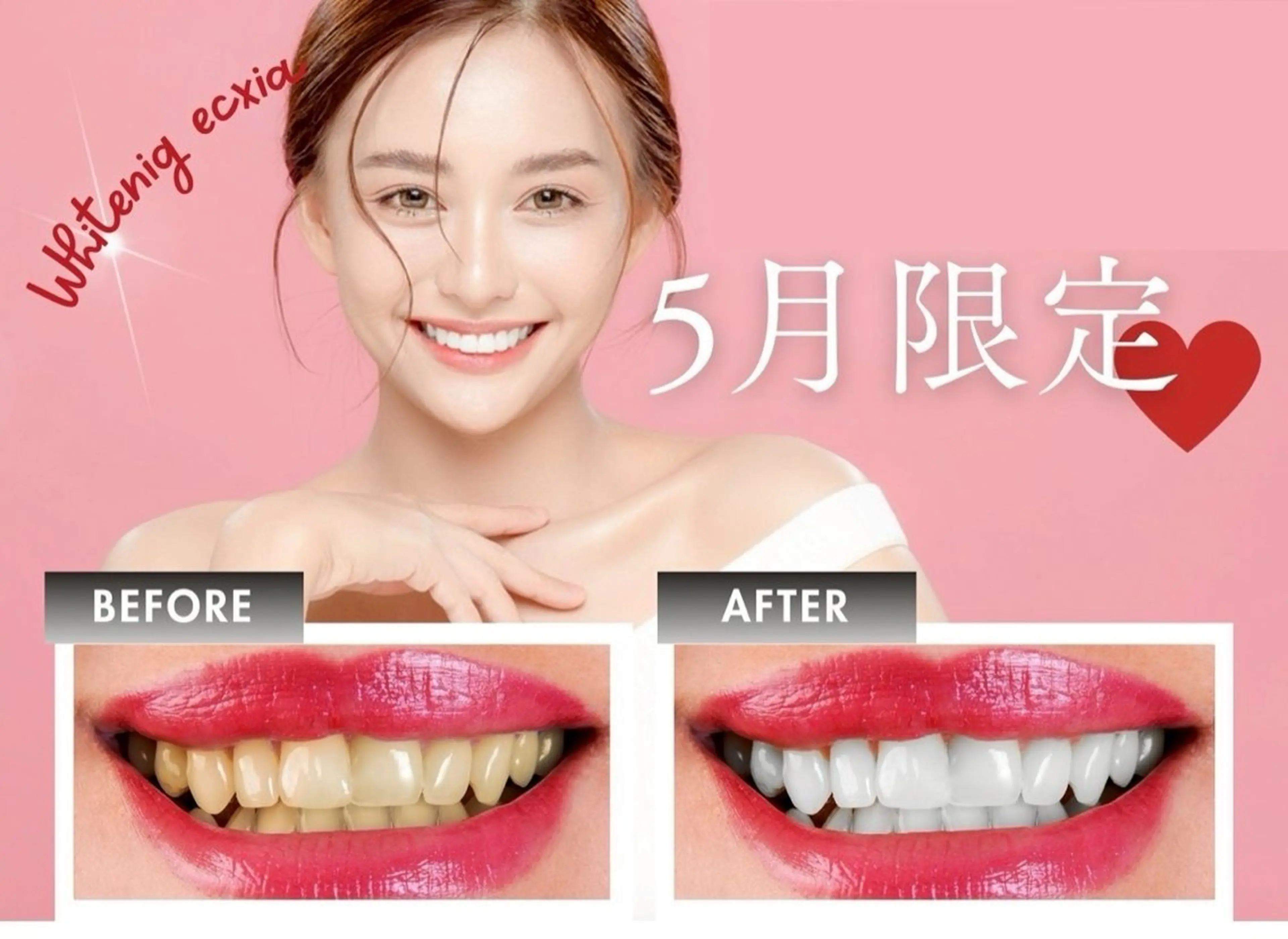 *⋆⸜ 5月限定 ⸝⋆*‬セルフホワイトニング¥3980→¥500の写真