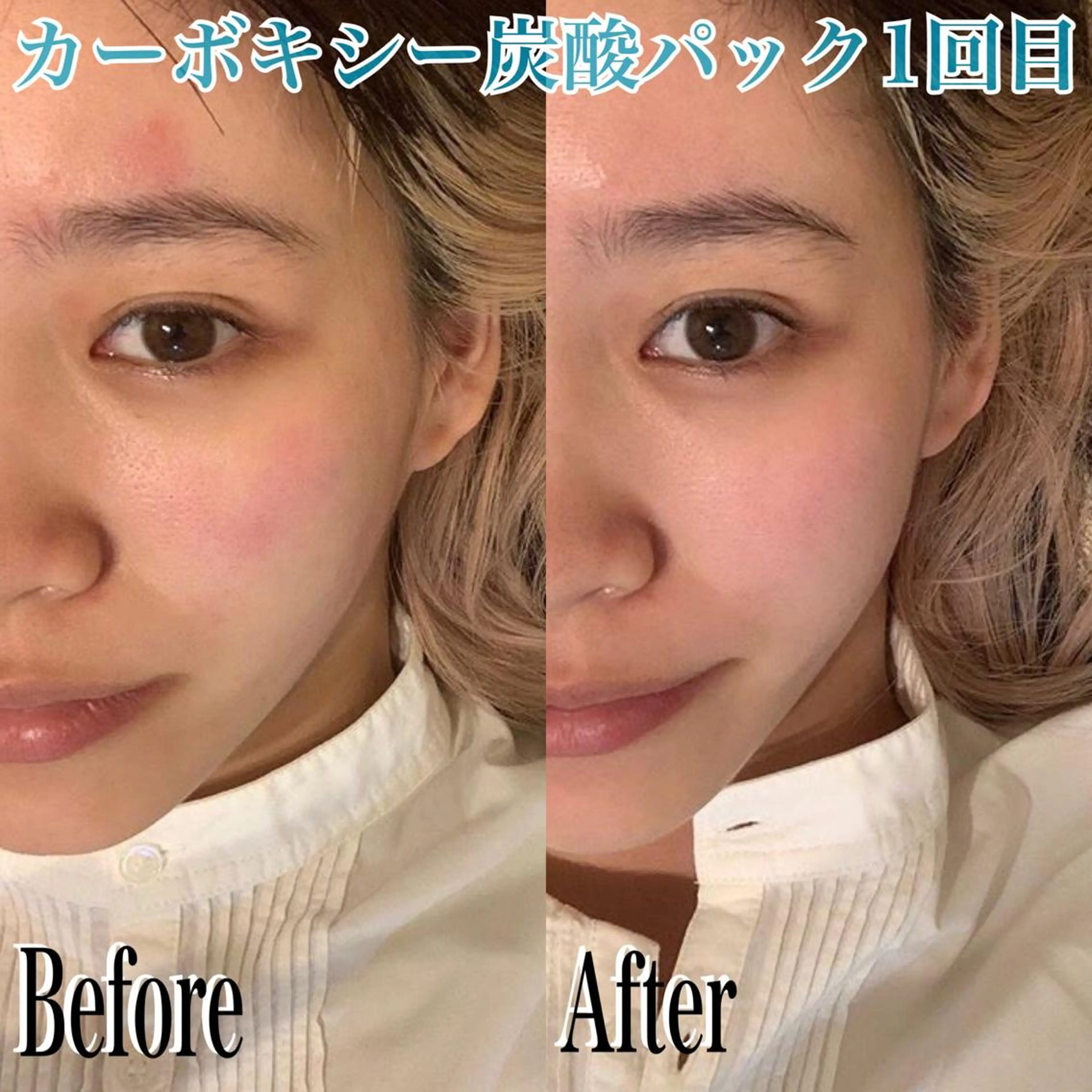 鍼灸整骨院Refine所属・鍼灸 Refineのその他イメージ