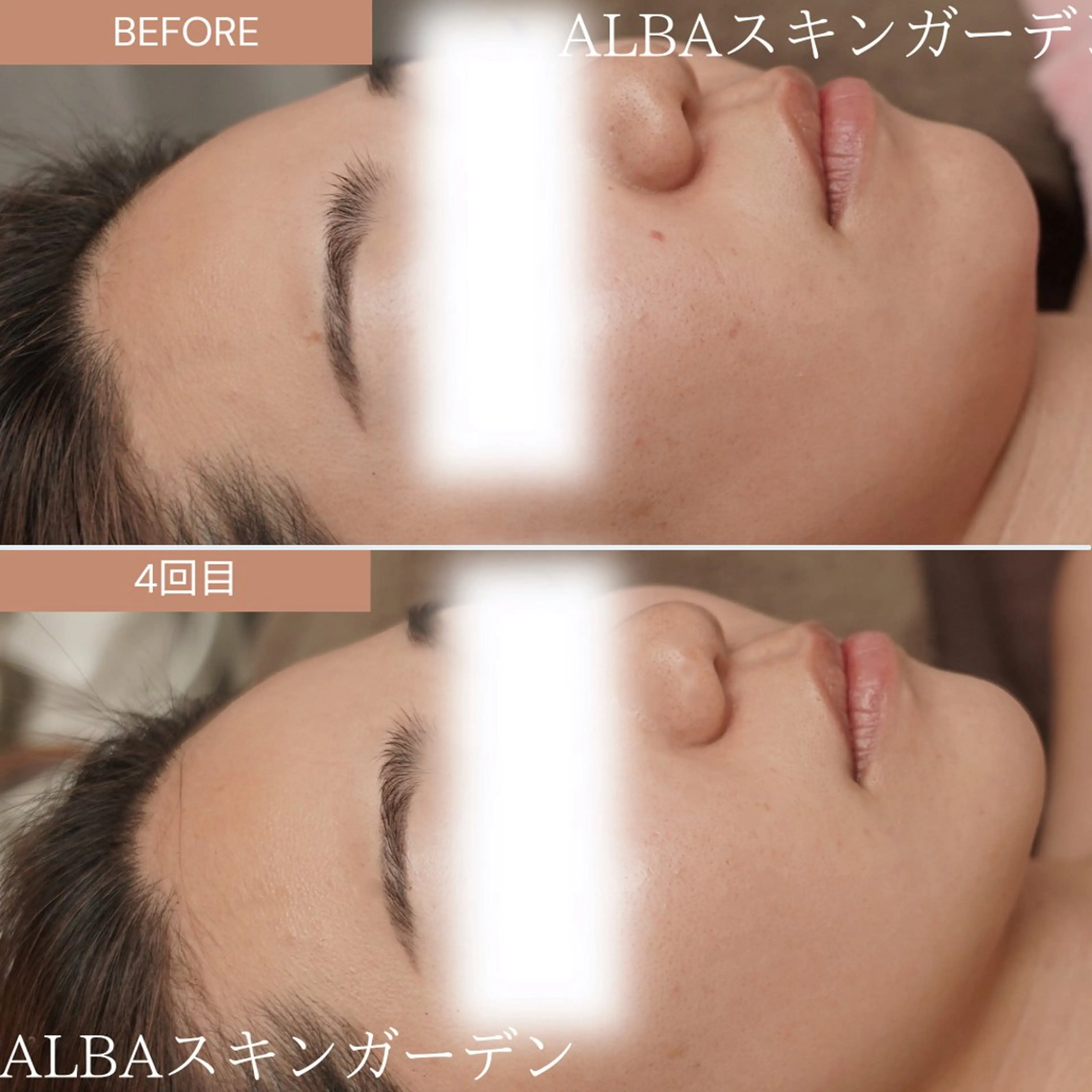 ALBAスキンガーデン所属・ALBA🌱 yuriのエステ・リラクイメージ