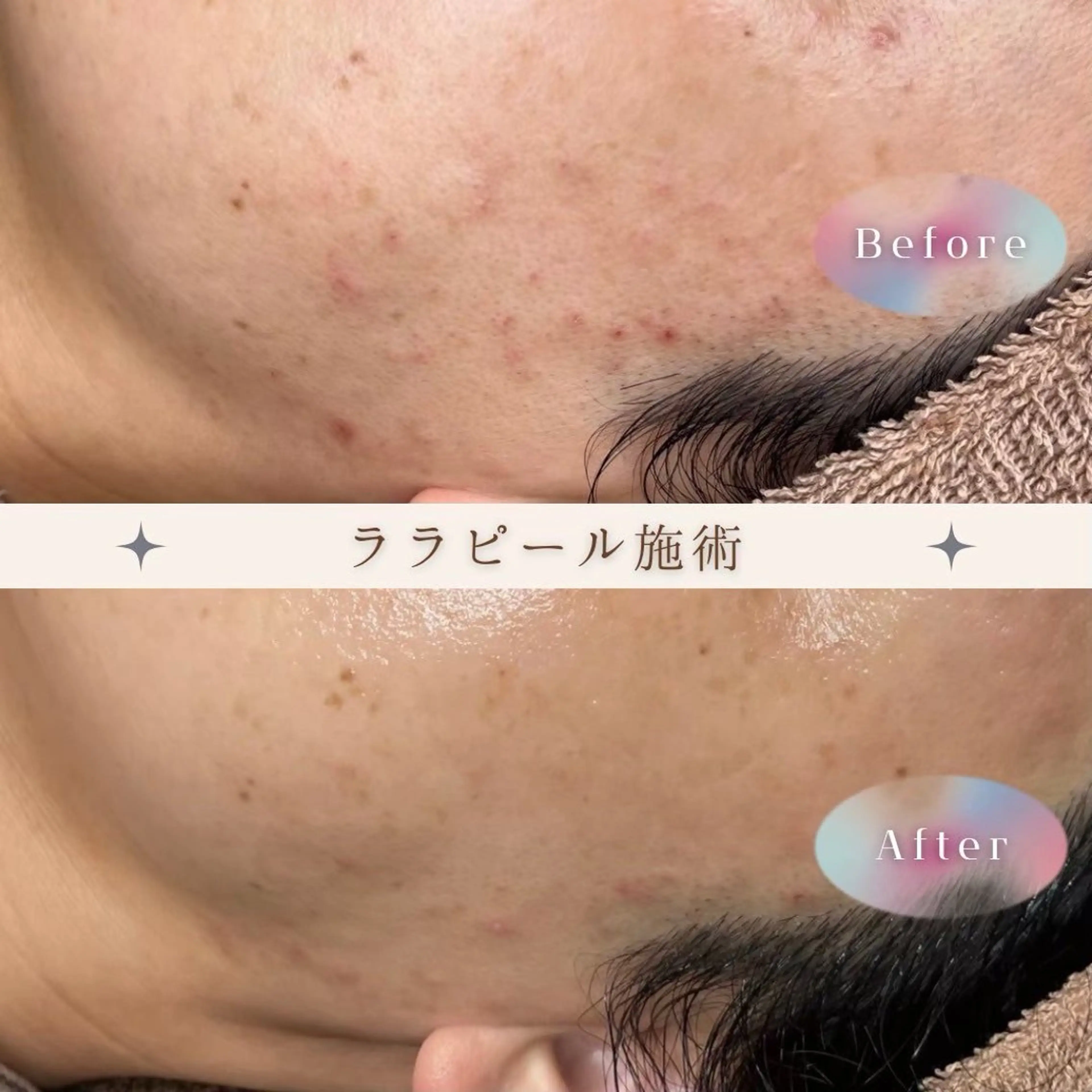 エステ LUANA ルアナのマツエク・マツパデザイン