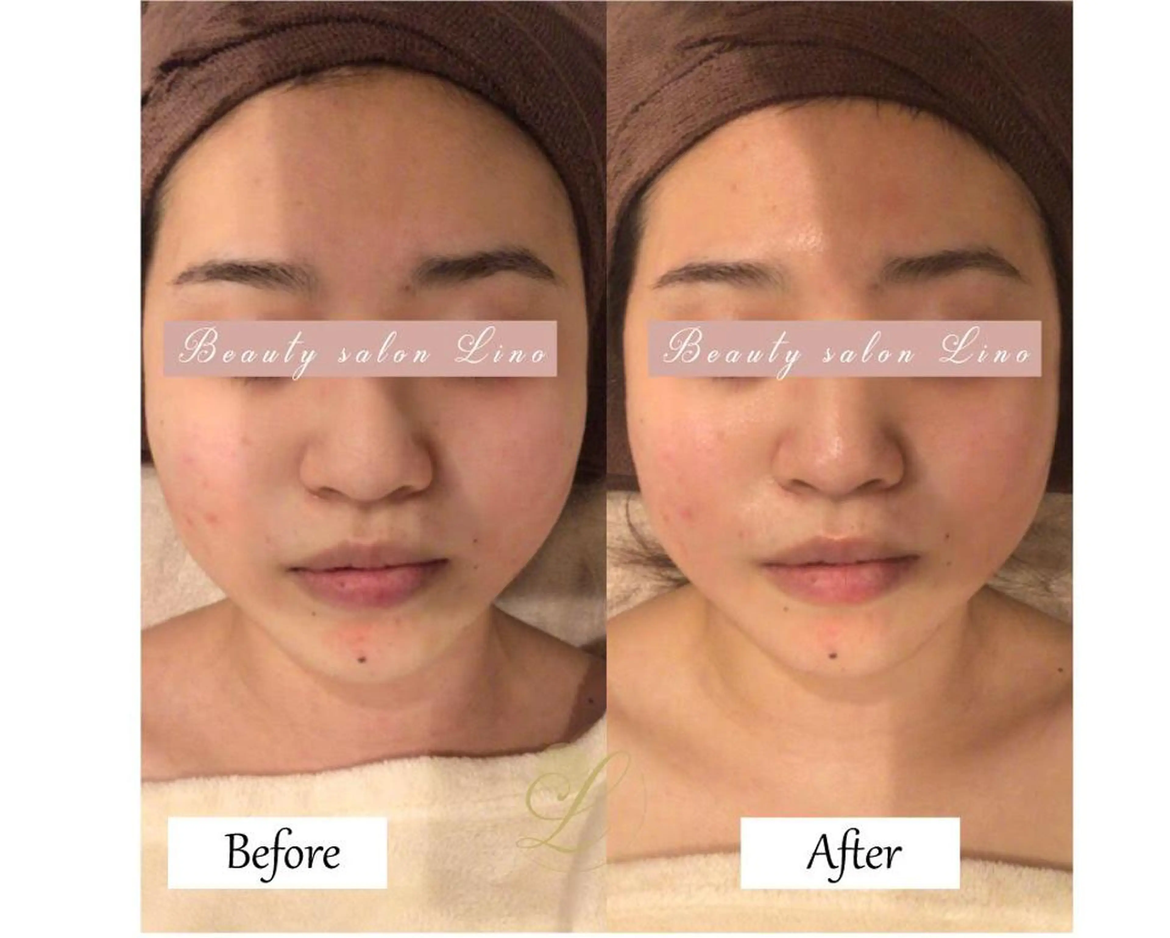 痩身×フェイシャル ブライダル|Linoのエステ・リラクイメージ