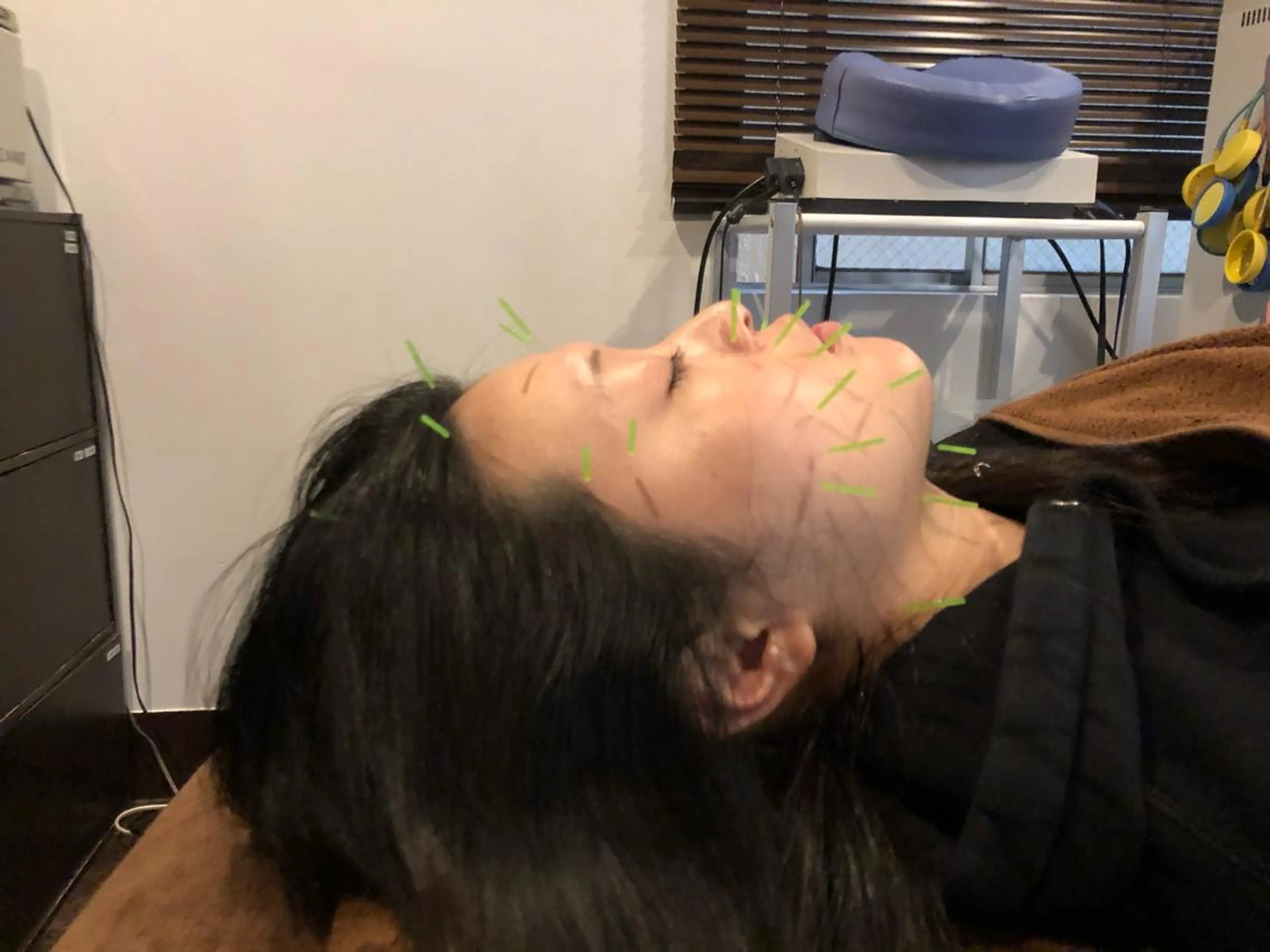 エステ リラク 美容鍼灸サロン LOMIHARIのエステ・リラクイメージ