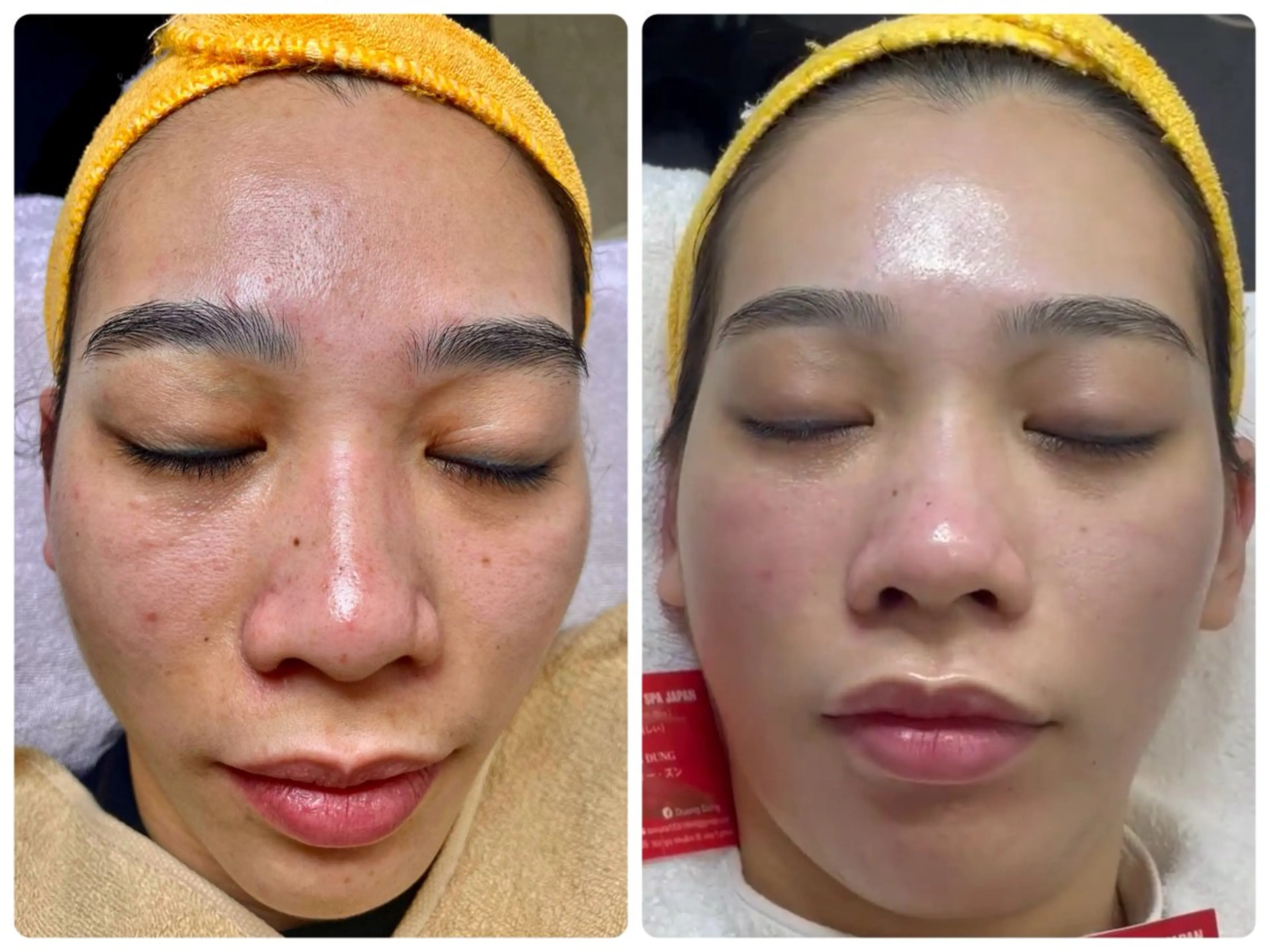 ニキビ、痩身、脱毛、 サクラチャンスパのエステ・リラクイメージ