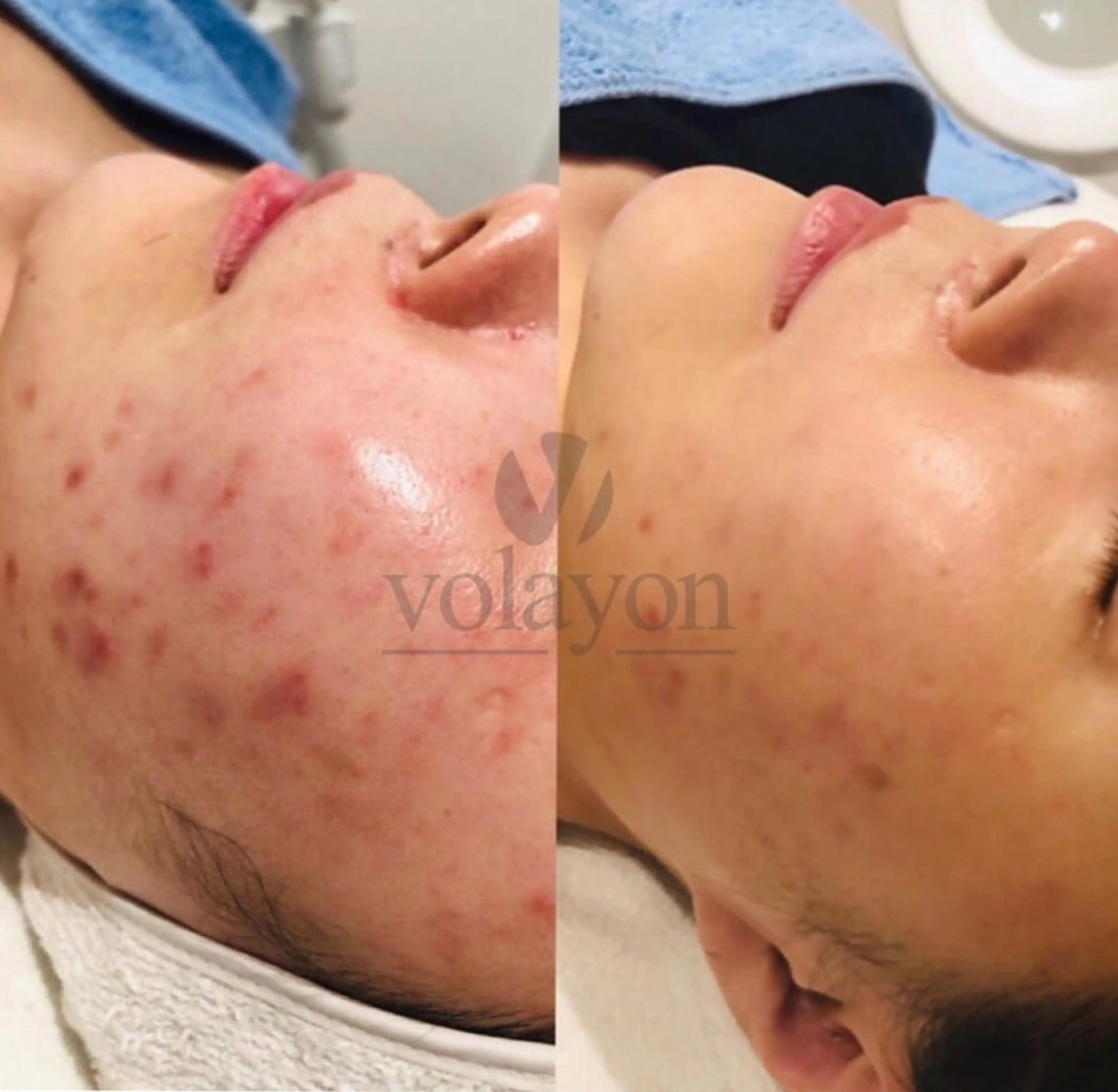 韓国風eyelush 眉毛サロン/Suuのマツエク・マツパデザイン