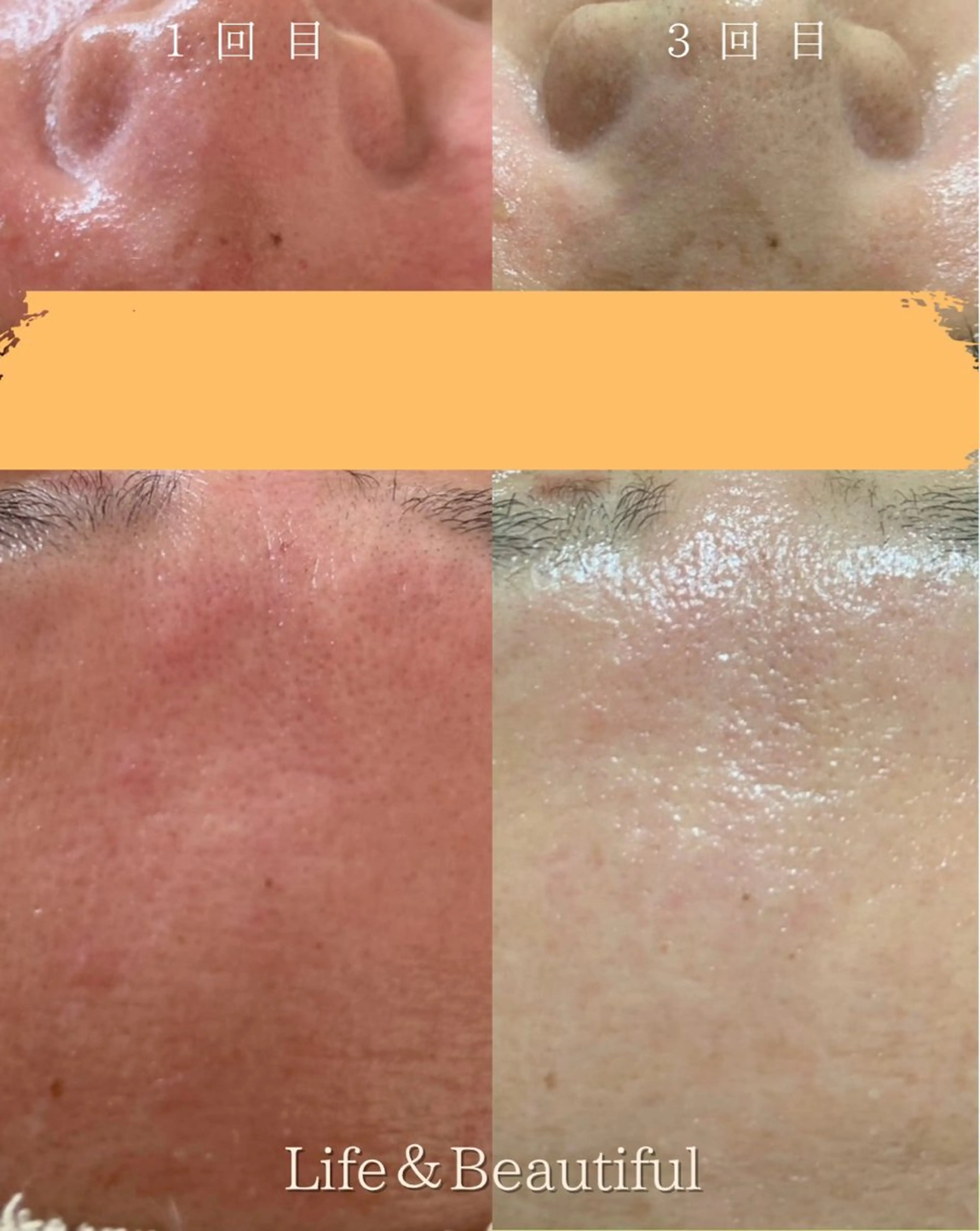 エステ Life＆ Beautifulのエステ・リラクイメージ