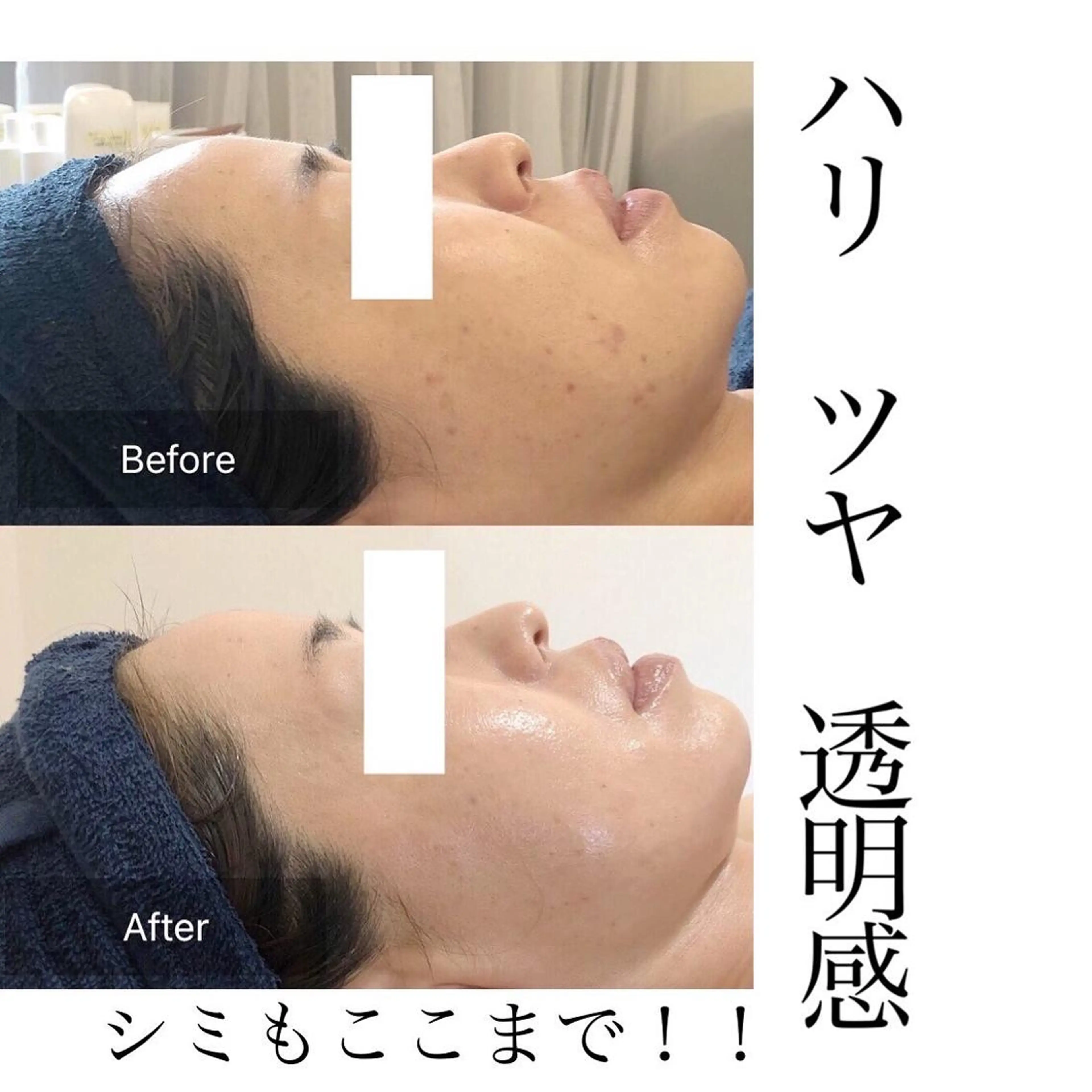エステ Fleur beauty salon所属・Fleur 児玉聖子のエステ・リラクイメージ