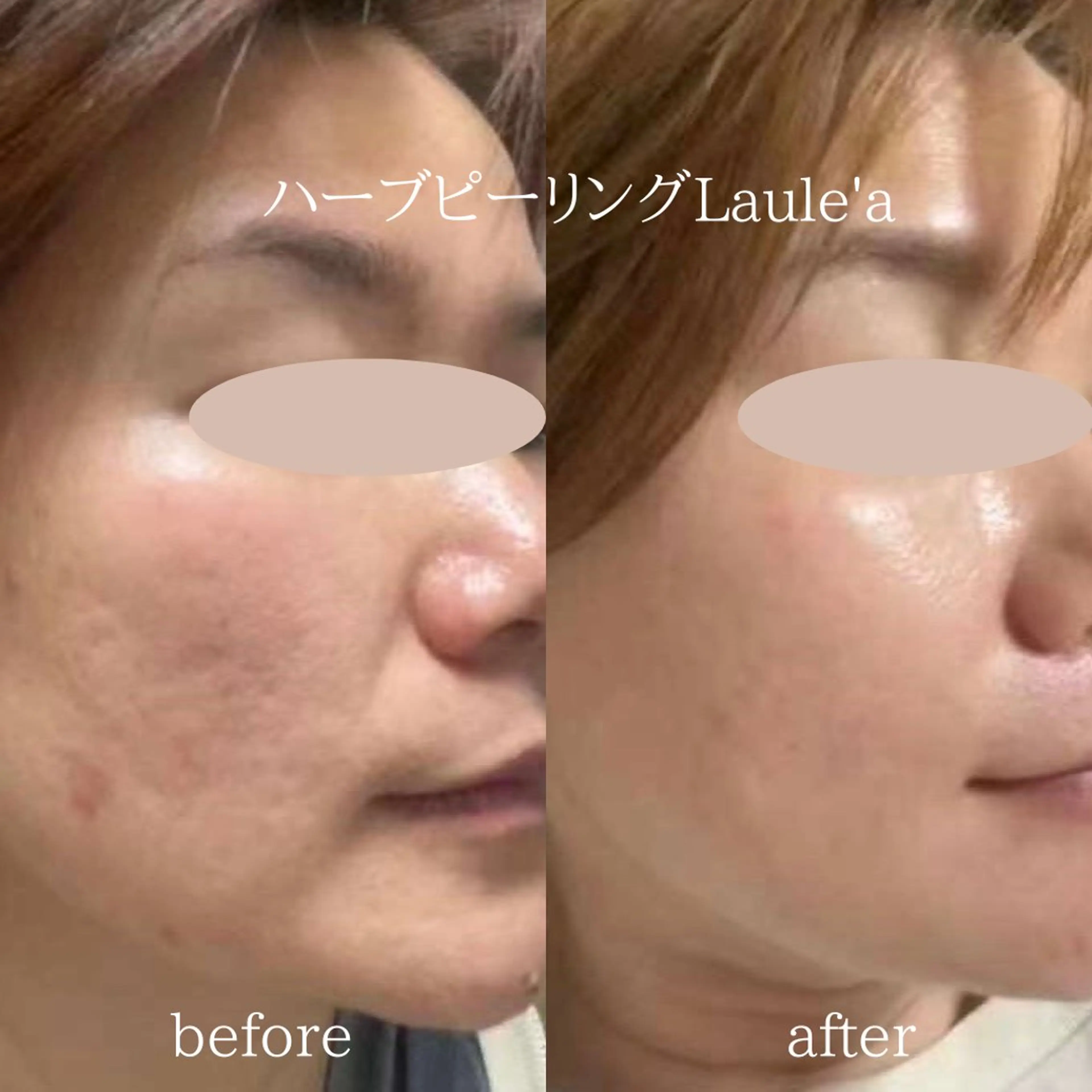 痩身/腸もみ/ ヘッドスパ/リンパのエステ・リラクイメージ