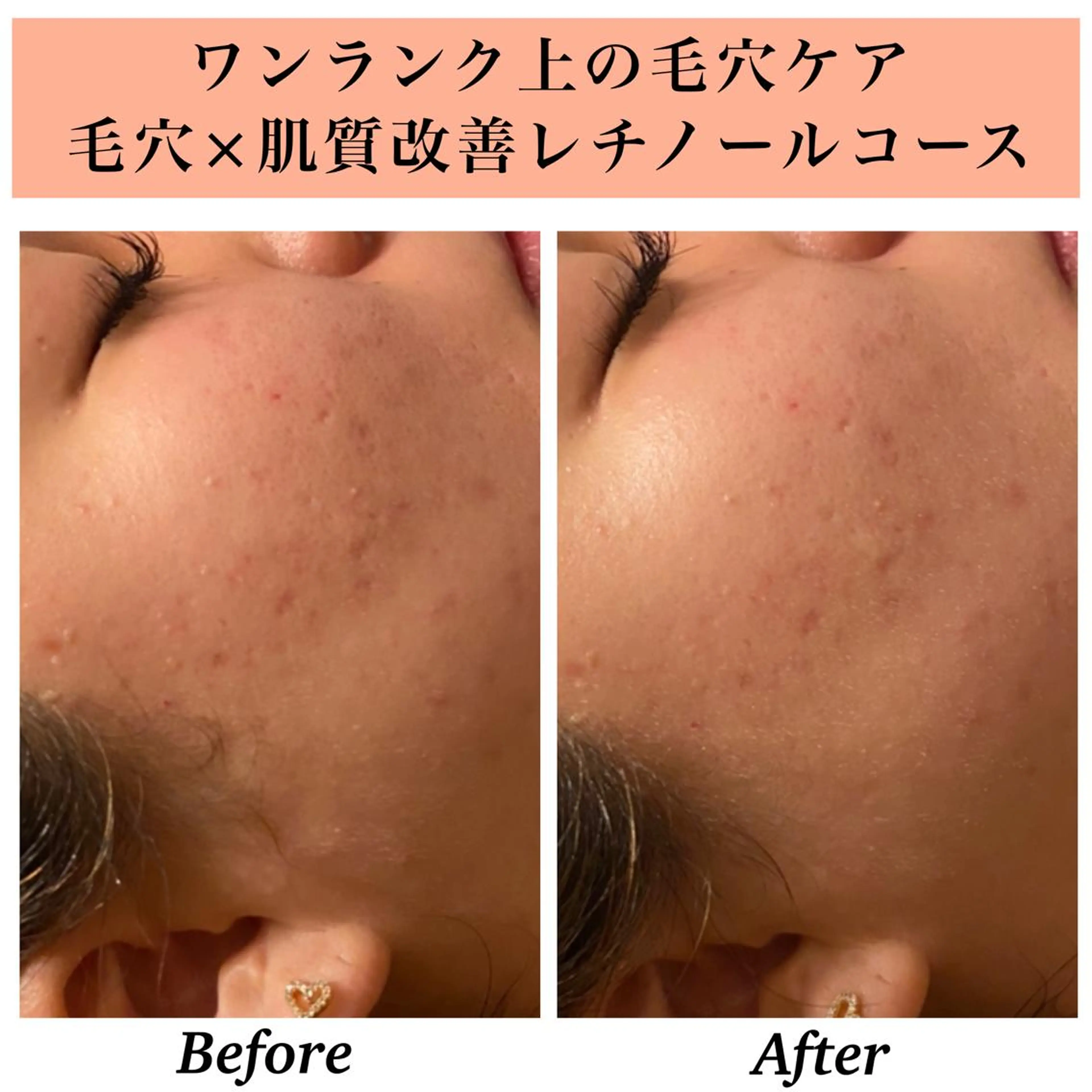 エステ リラク Bellesthe (ベルエステ)のエステ・リラクイメージ