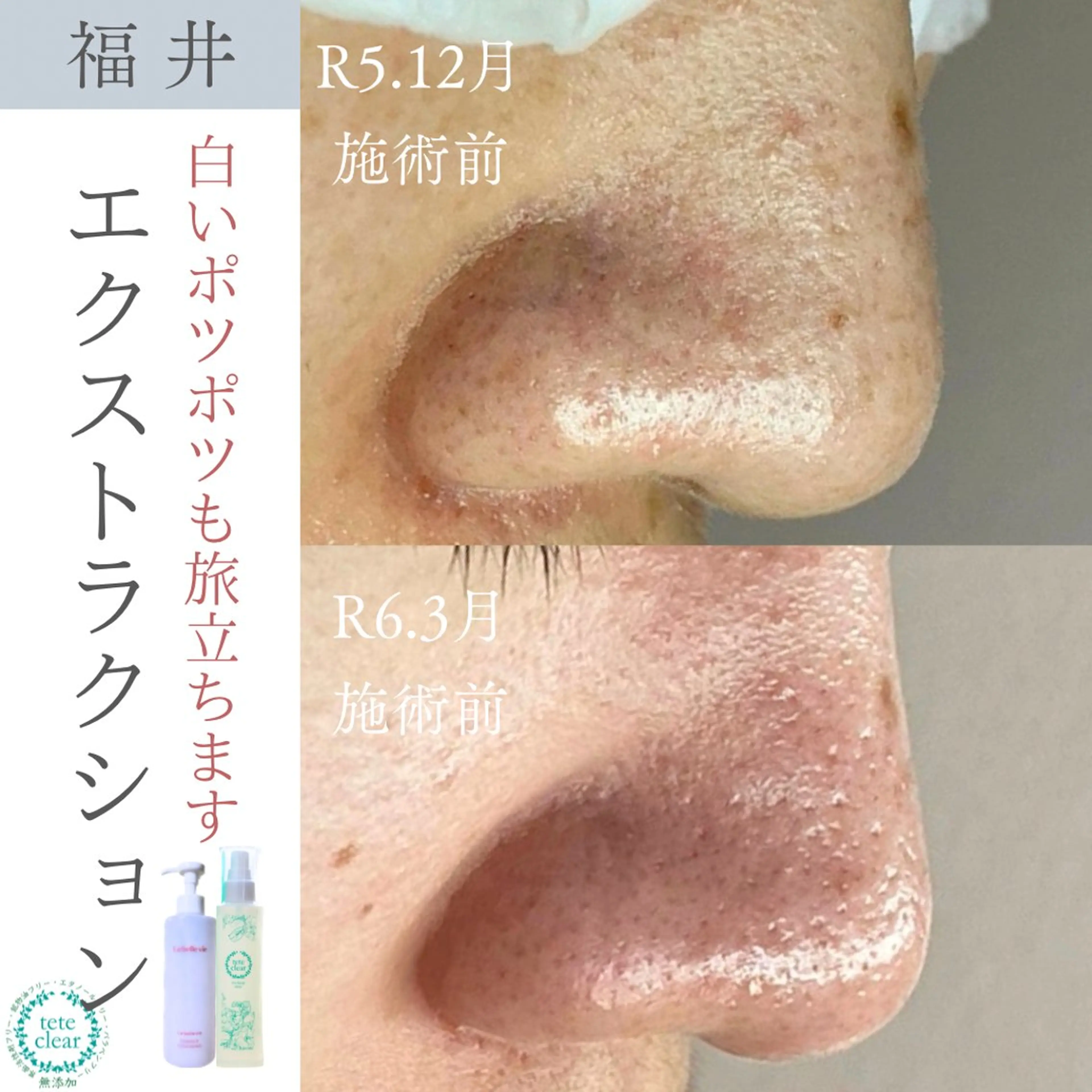 毛穴ケア専門サロン Yourmeユアミーのエステ・リラクイメージ