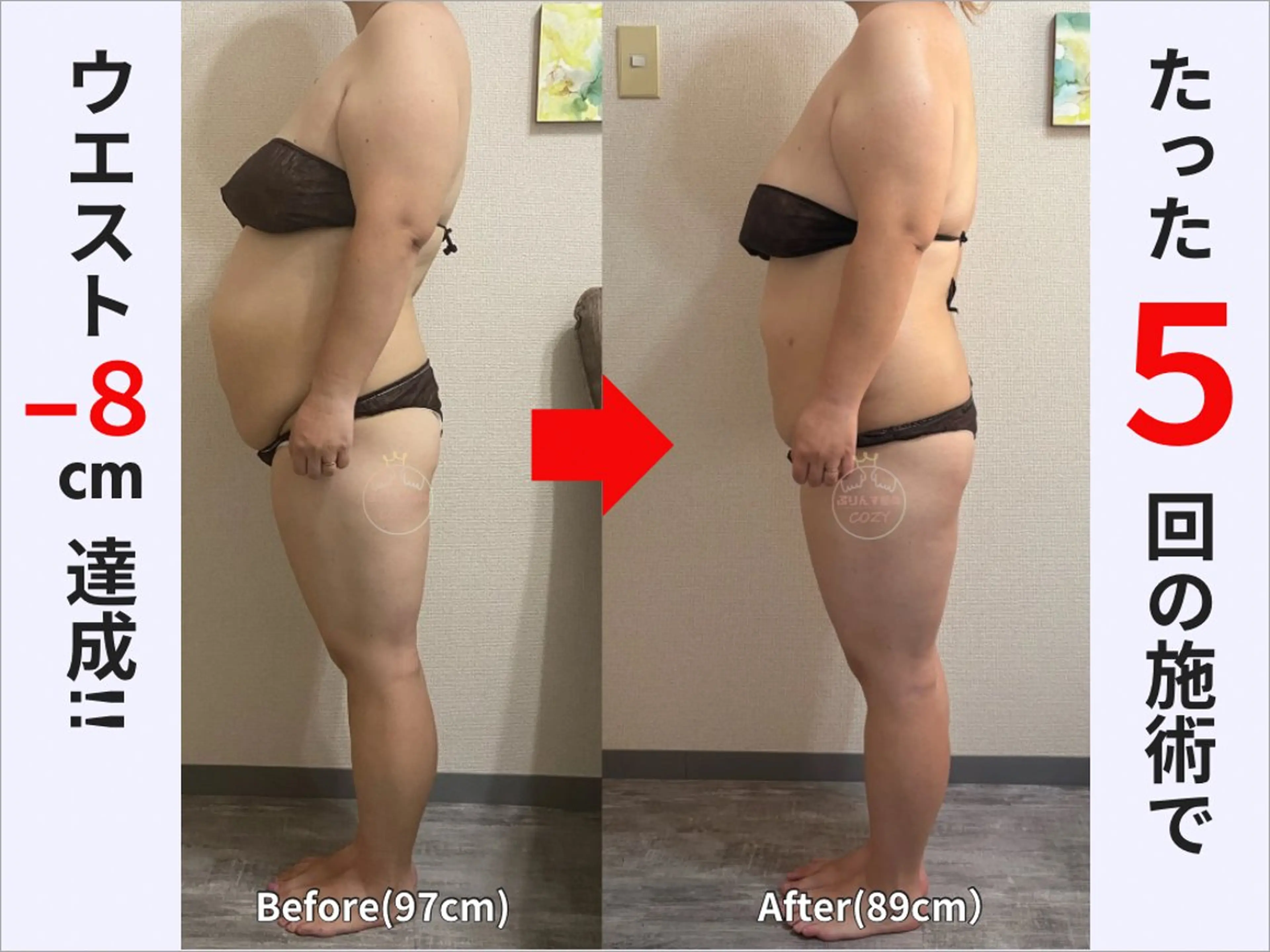 エステ リラク 骨盤矯正ダイエット ぷりんす整体COZYのエステ・リラクイメージ